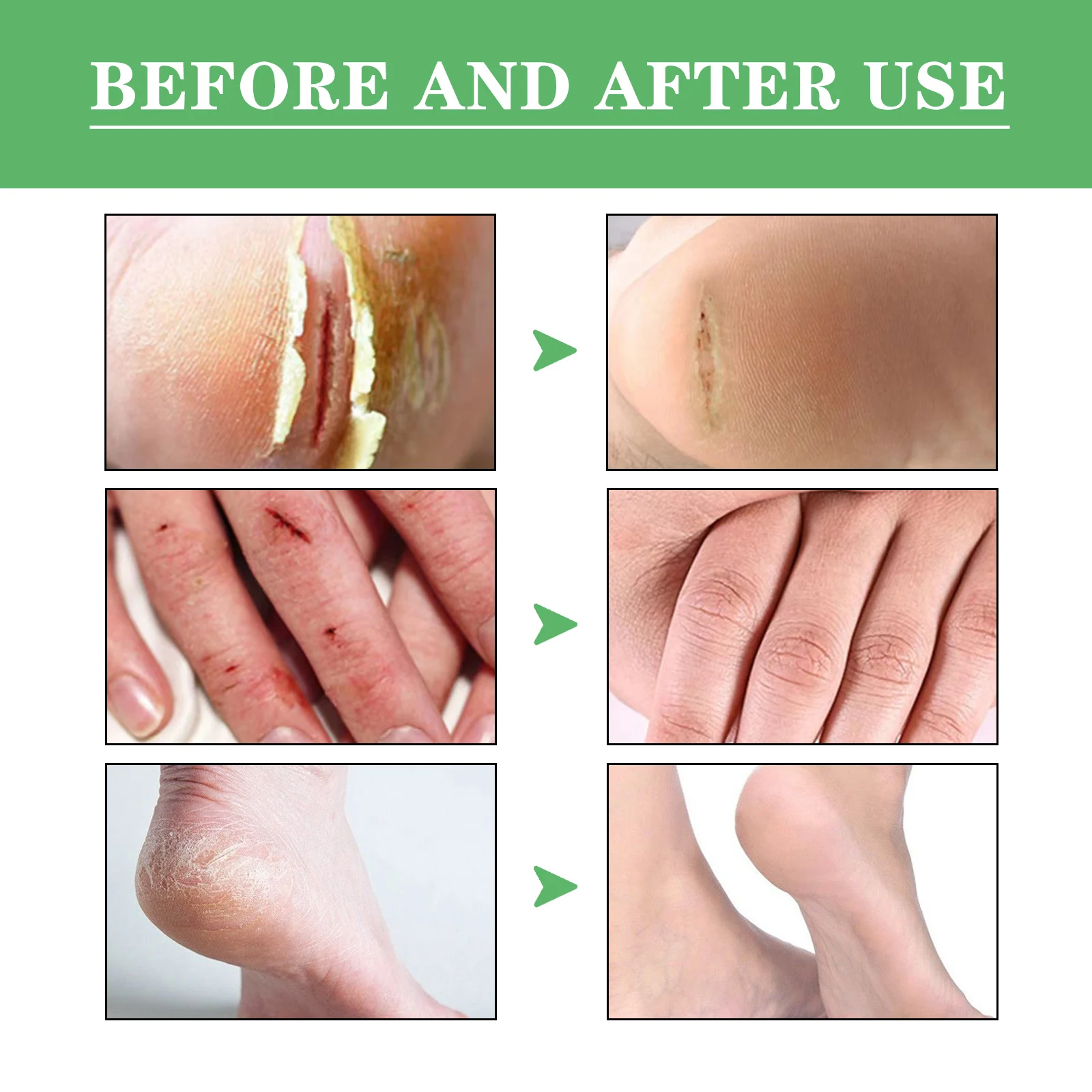 Dry Crack Protection Hand Foot Cream 30g Avocado Moisturizing Repair Balm for Chapped Skin 9 dry crack protection hand foot cream 30g avocado cih 3v5w7frv desc 9