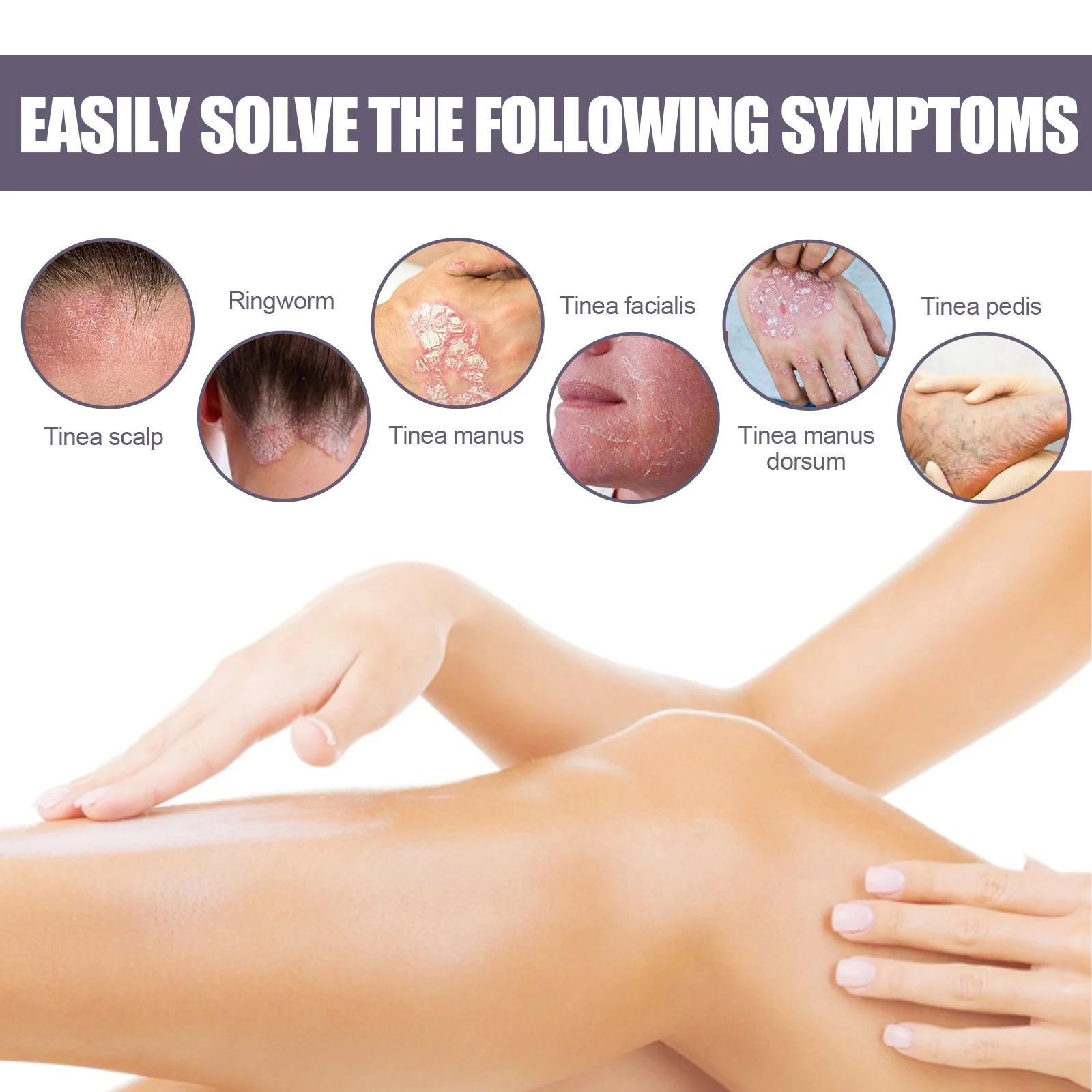 Eczema & Psoriasis Spray with Plant Ingredients Relieves Dry Itchy Skin 30ml 5 eczema psoriasis spray dry itchy skin relief 30ml cih a2rt7uqs desc 5
