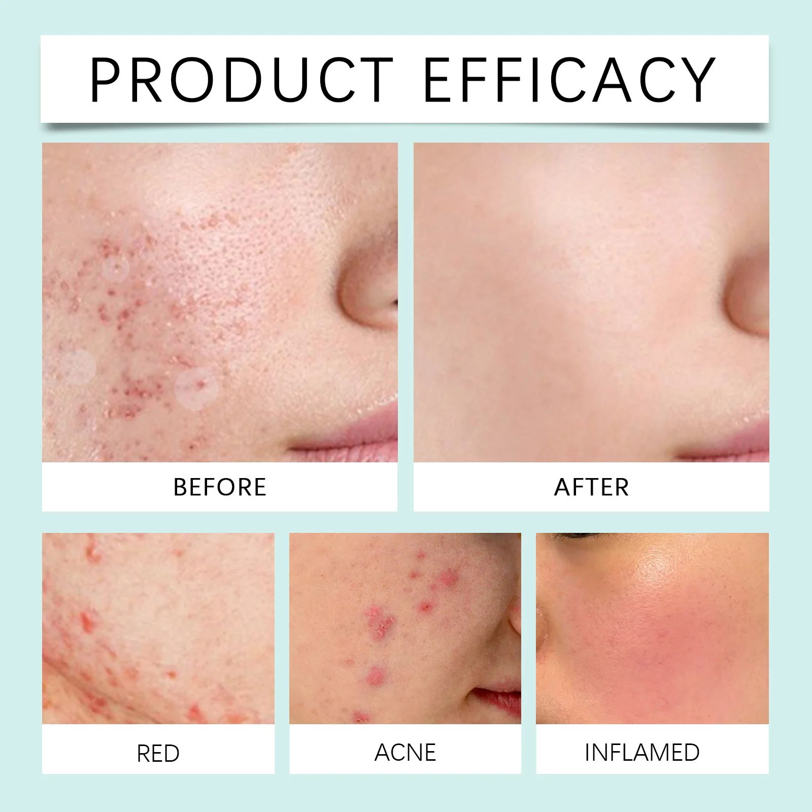 Acne Patches Skincare Set for Pimple Treatment with Tea Tree Oil, Variety Pack of 7 Shapes & Sizes (306pcs) 12 eelhoe acne patches skincare set 306pcs variety pack cih k2fmycdd desc 12