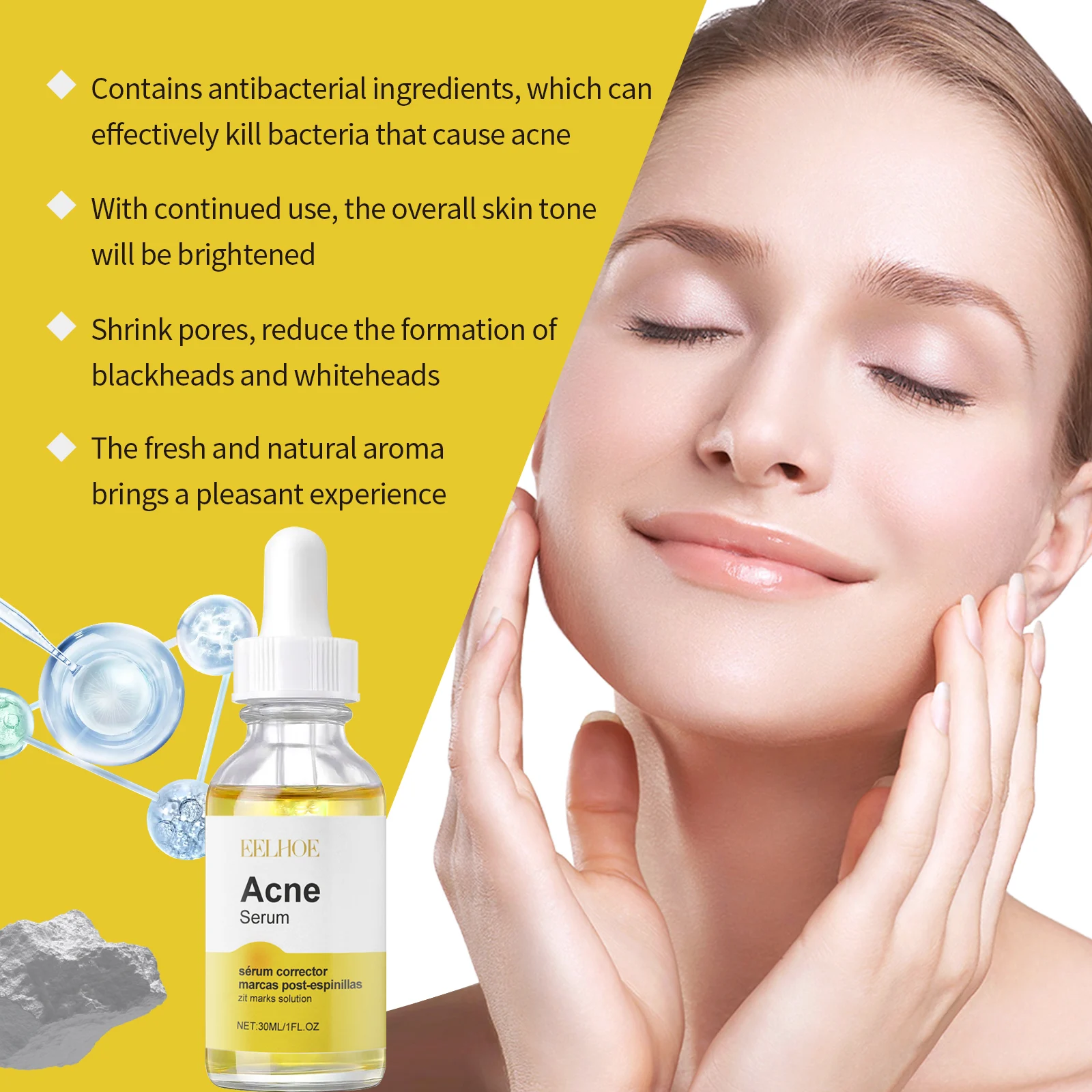 Acne Serum for Face 30ml - Repair Acne Marks, Control Oil, & Clear Skin 6 eelhoe acne serum 30ml cih k3ggm77t desc 6