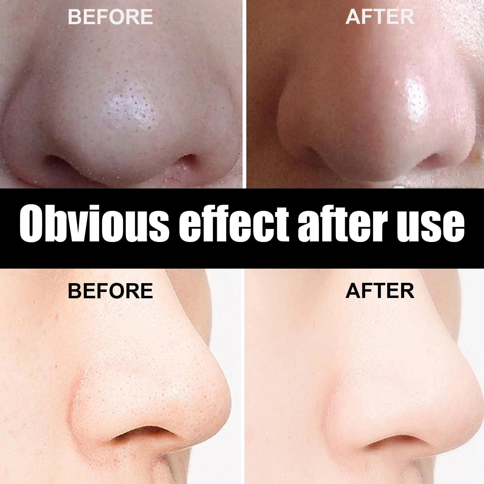 Blackhead Removal Nose Mask Deep Cleansing Pore Strip 30g 10 eelhoe blackhead removal nose mask pore strip 30g cih wauzkkry desc 10