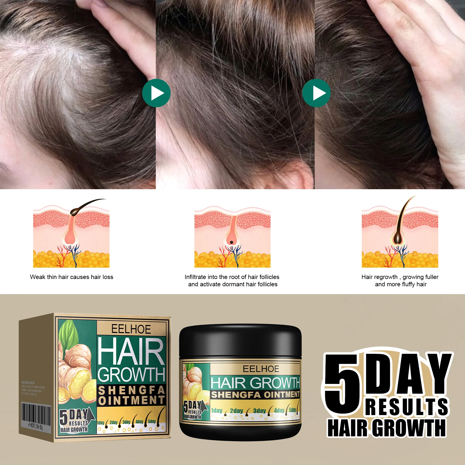 Ginger Hair Cream - Prevent Hair Loss & Nourish Scalp - 100g Hair Growth Treatment 6 eelhoe ginger hair cream 100g hair growth treatment cih 3yddqcd8 desc 6