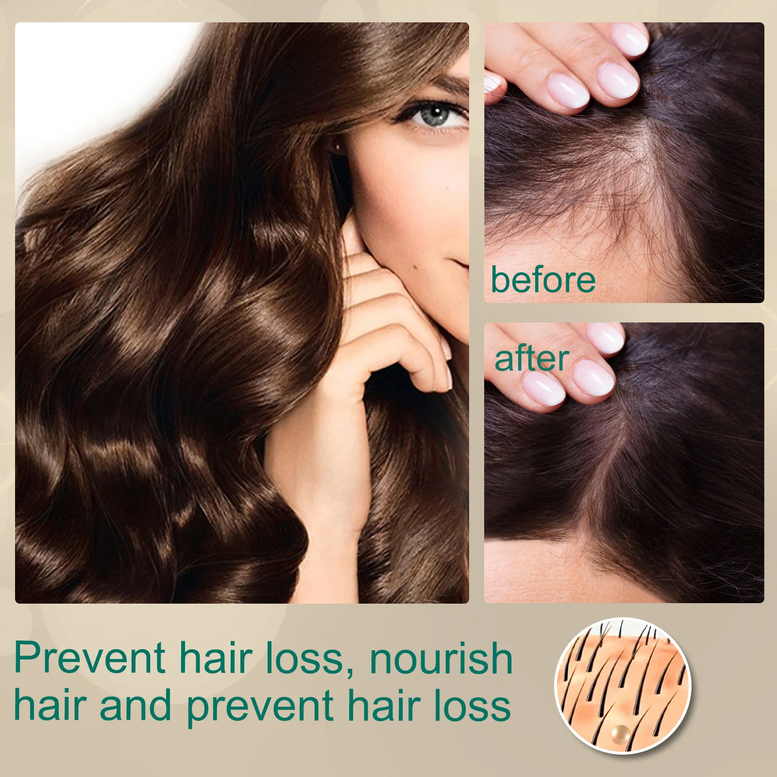 Ginger Hair Cream - Prevent Hair Loss & Nourish Scalp - 100g Hair Growth Treatment 7 eelhoe ginger hair cream 100g hair growth treatment cih 3yddqcd8 desc 7