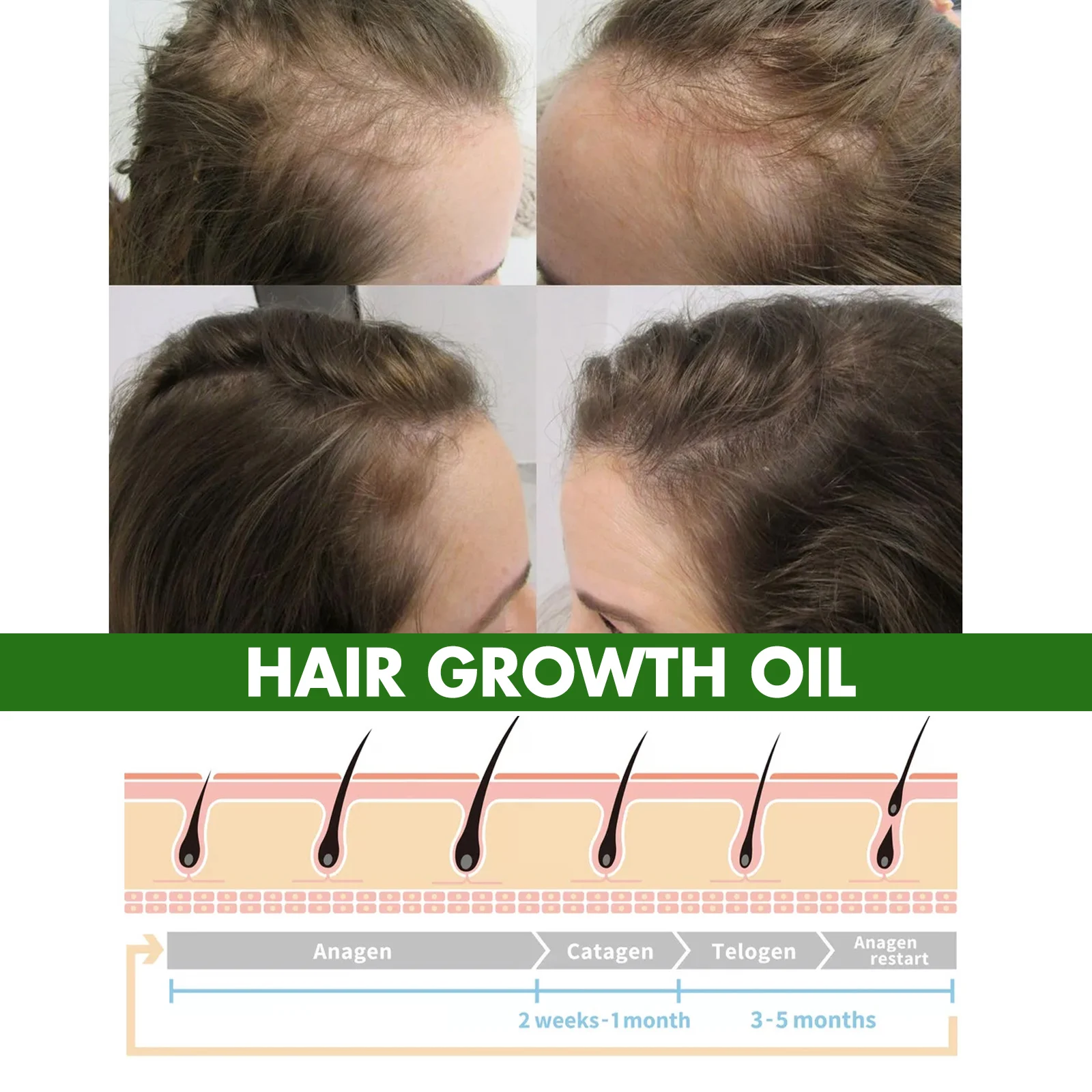 Hair Growth Oil 100ml Strengthens Hair from Roots, Reduces Hair Loss & Premature Greying 6 eelhoe hair growth oil 100ml cih zksjvwx2 desc 6