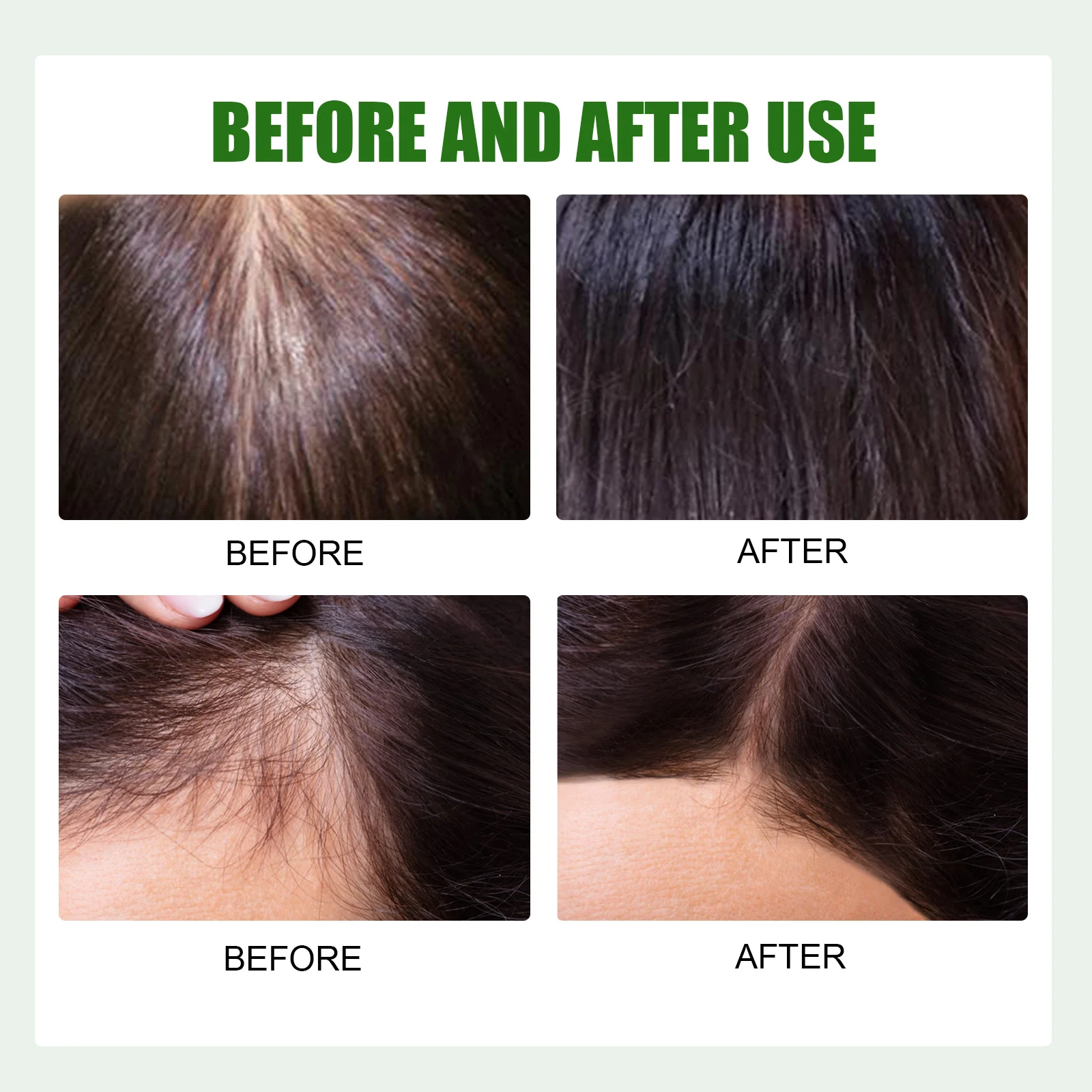 Hair Growth Oil 100ml Strengthens Hair from Roots, Reduces Hair Loss & Premature Greying 7 eelhoe hair growth oil 100ml cih zksjvwx2 desc 7