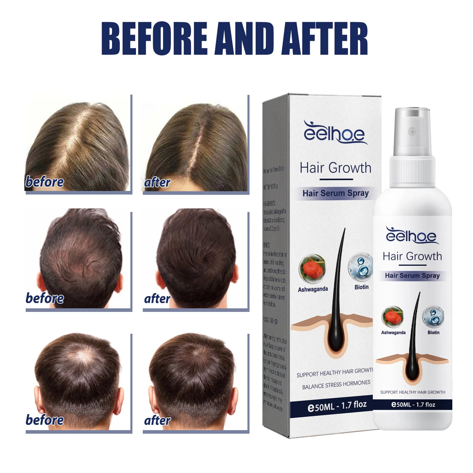 Herbal Hair Growth Oil 50ml for Thickening, Strengthening & Reducing Hair Loss 6 eelhoe herbal hair growth oil 50ml cih n386nv4b desc 6