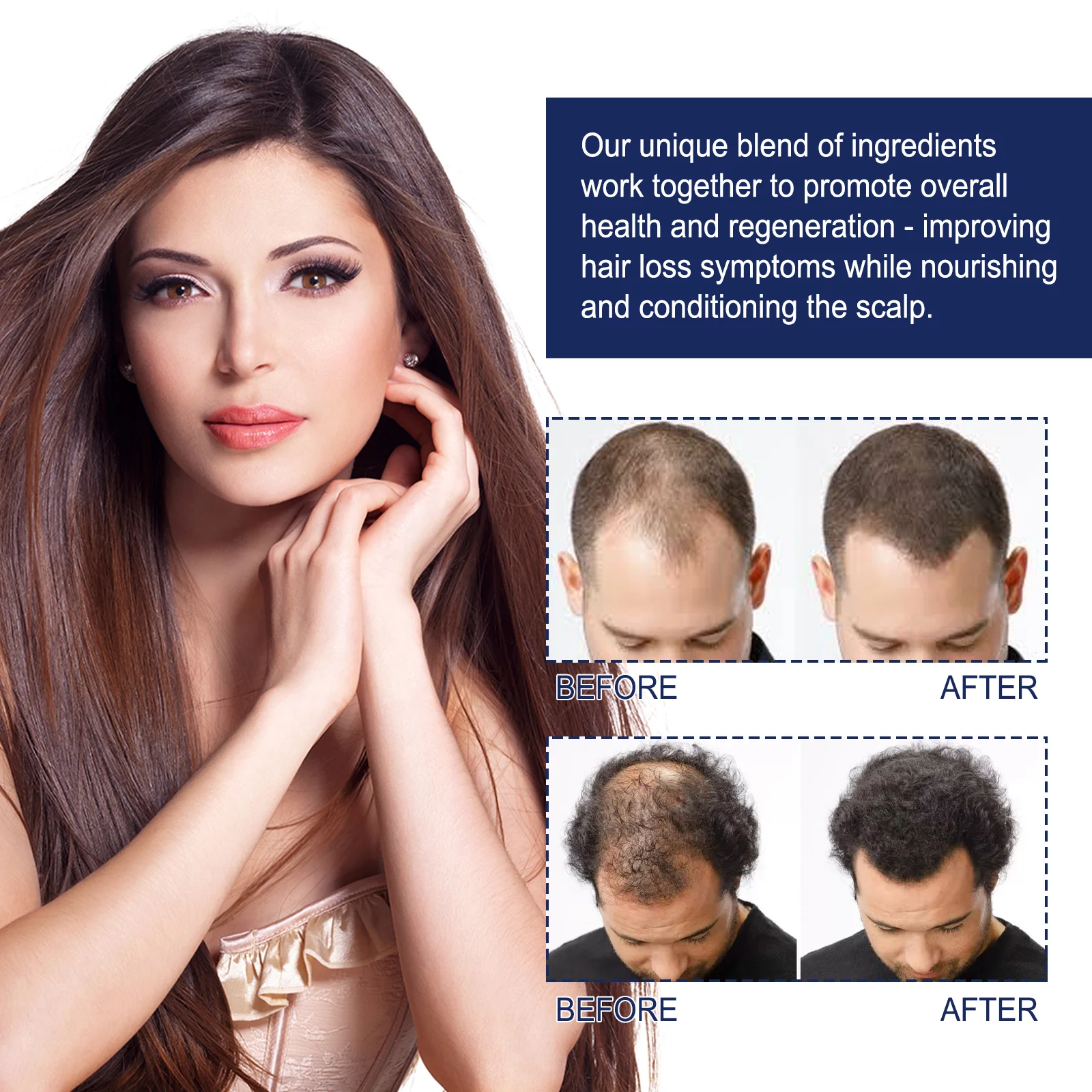 Herbal Hair Growth Oil 50ml for Thickening, Strengthening & Reducing Hair Loss 9 eelhoe herbal hair growth oil 50ml cih n386nv4b desc 9