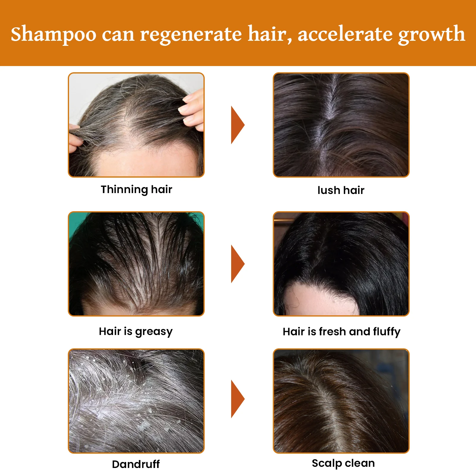 Rice Water Hair Growth Shampoo for Thicker Longer Fuller Hair with Biotin & Ginger Extract 100ml 7 eelhoe rice water hair growth shampoo 100ml cih py5gwaay desc 7