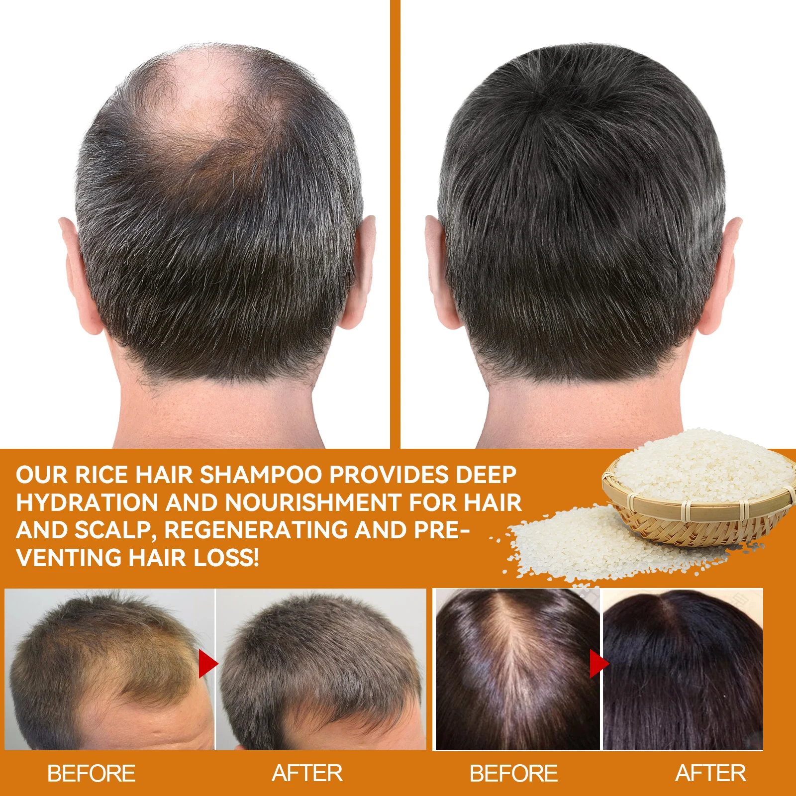 Rice Water Hair Growth Shampoo for Thicker Longer Fuller Hair with Biotin & Ginger Extract 100ml 9 eelhoe rice water hair growth shampoo 100ml cih py5gwaay desc 9