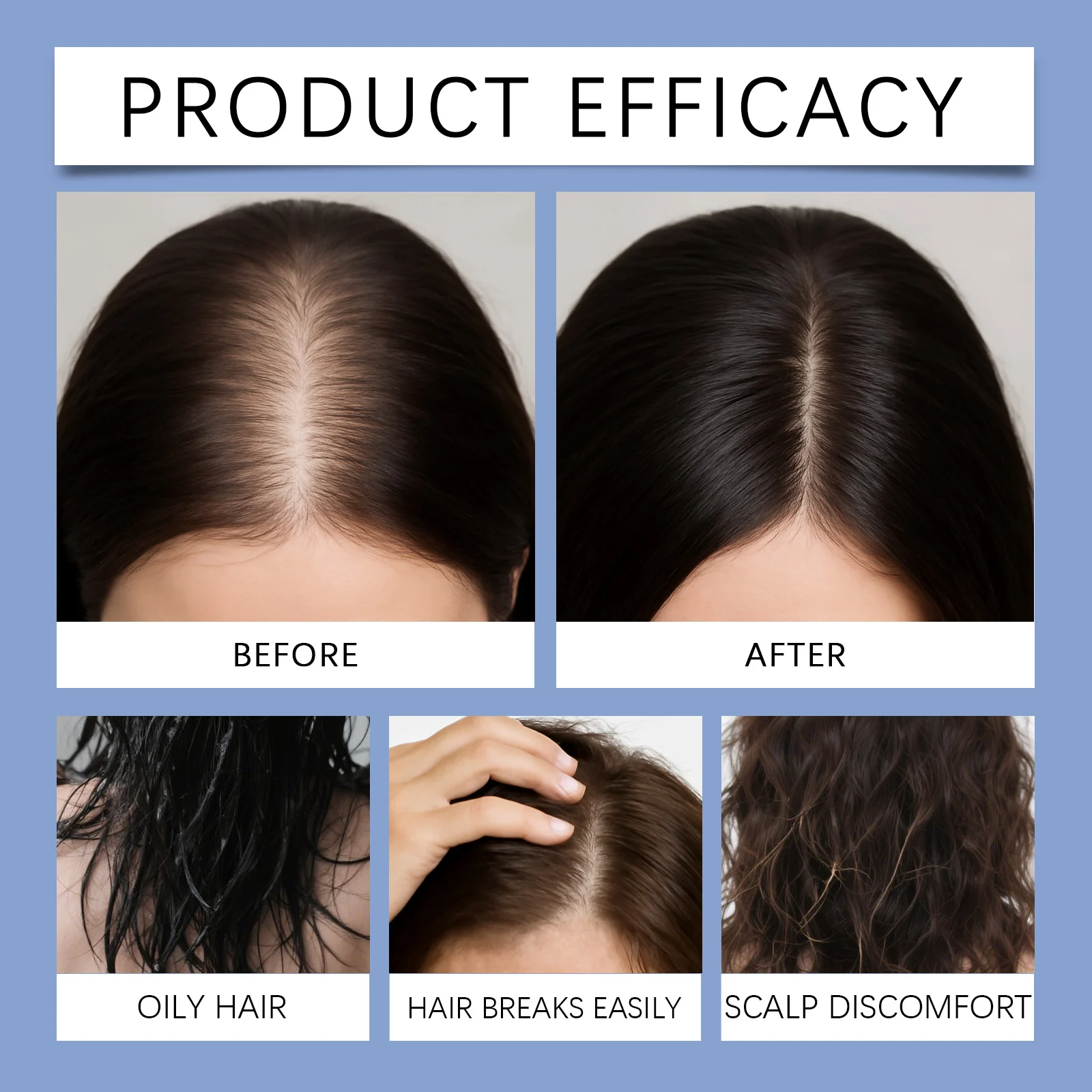 Scalp Serum 10ml for Nourishing & Refreshing Scalp Care, Suitable for All Hair Types 12 eelhoe scalp serum 10ml der 5tjecqgh desc 12