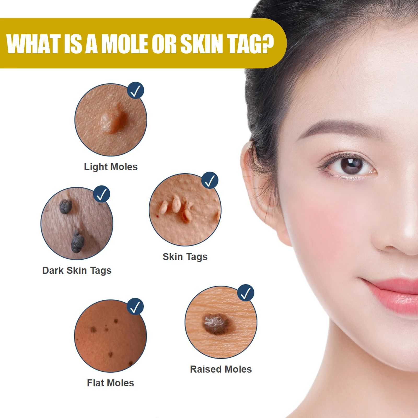 Skin Tag Remover Serum for Moles, Warts & Skin Tags, 30ml Gentle Formula 6 eelhoe skin tag remover serum 30ml cih 5bj39wx2 desc 6
