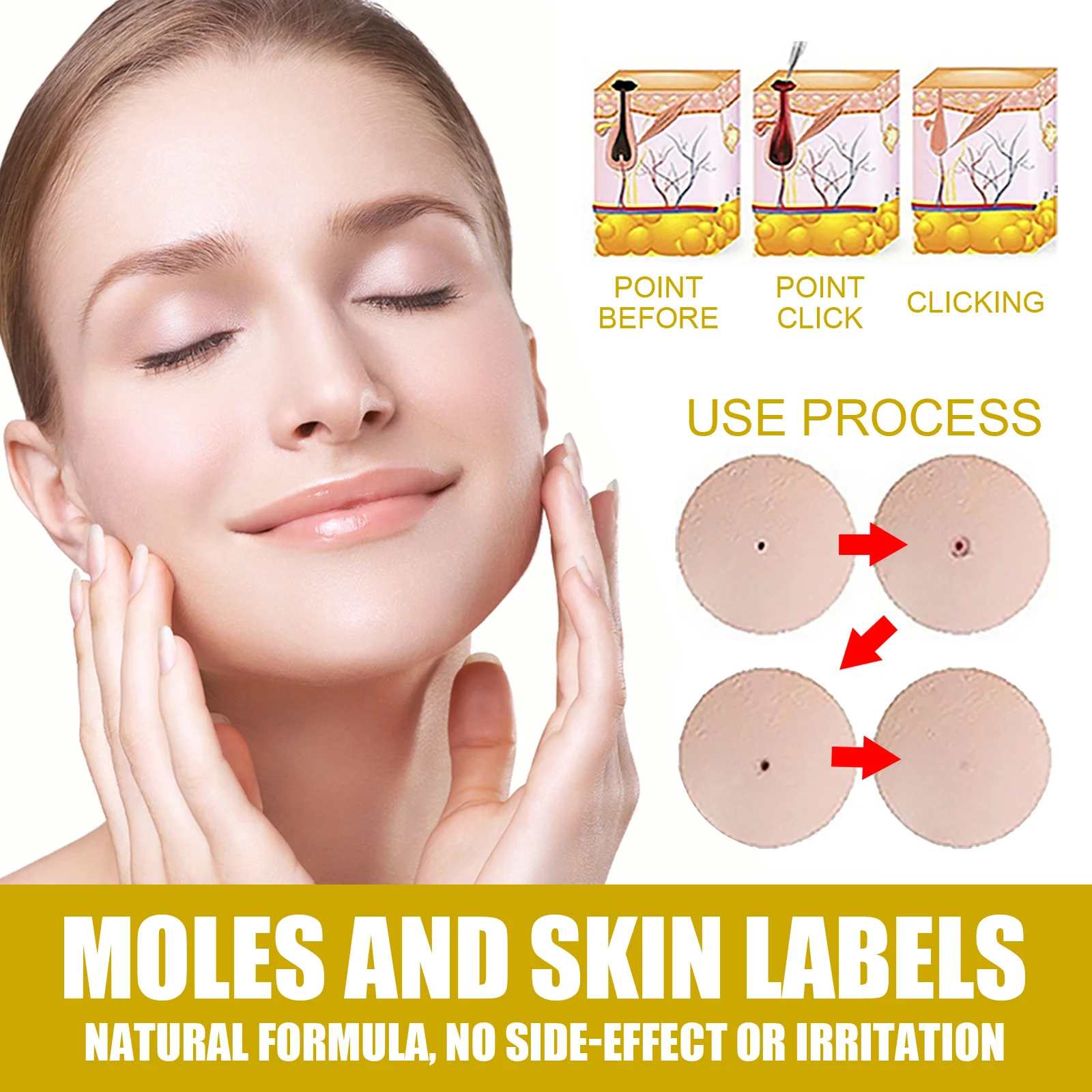 Skin Tag Remover Serum for Moles, Warts & Skin Tags, 30ml Gentle Formula 8 eelhoe skin tag remover serum 30ml cih 5bj39wx2 desc 8