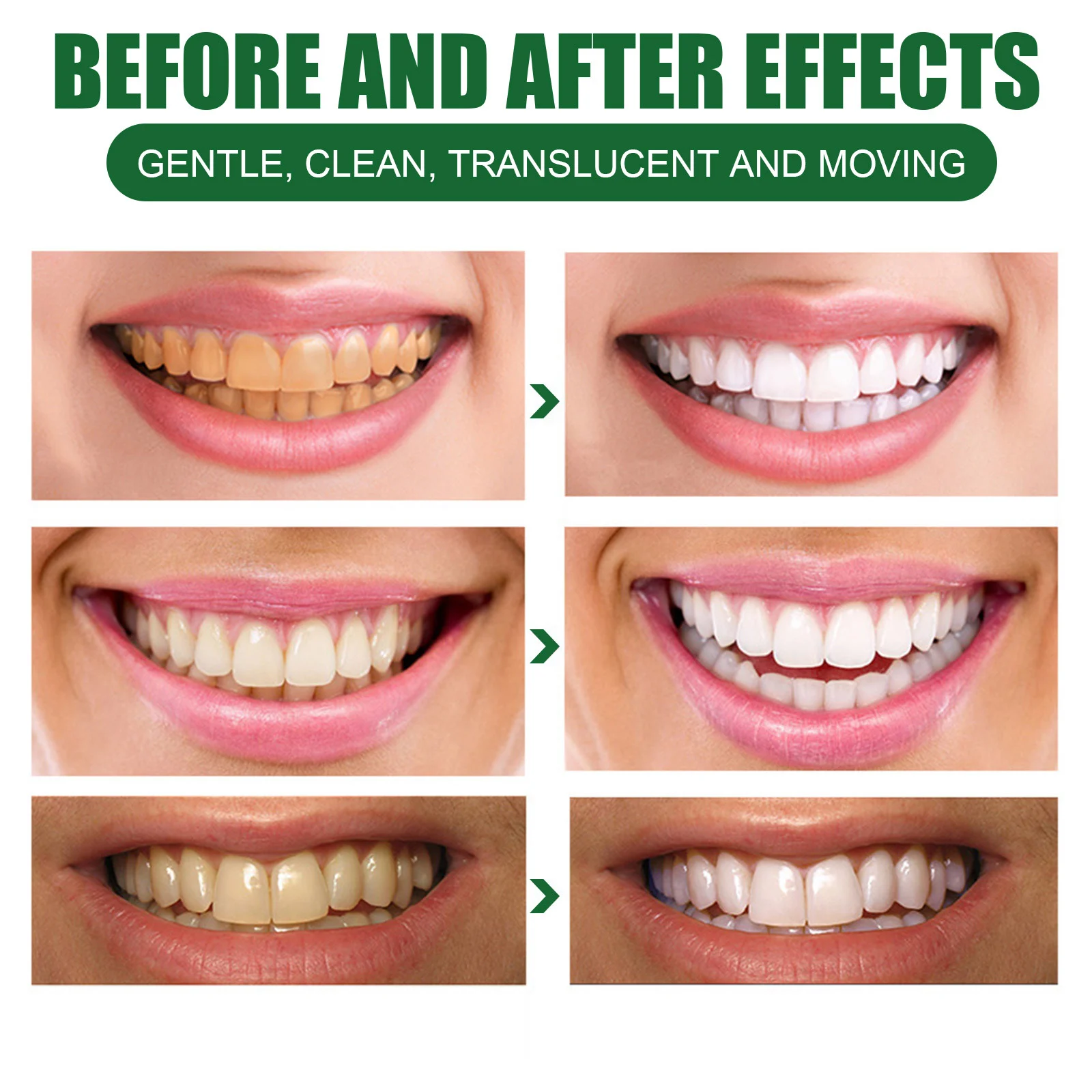 Teeth Whitening Mousse 60ml Tartar Remover Stain Cleaner Fresh Breath Oral Care 6 eelhoe teeth whitening mousse 60ml cih vvj5dtac desc 6