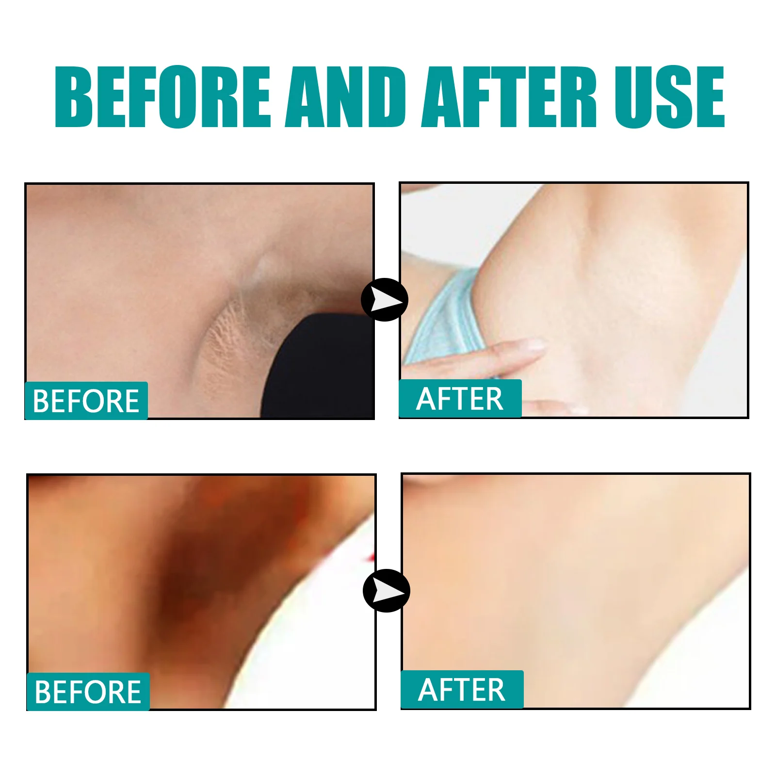 Underarm Brightening Serum 30ml with Tocopherol & Ascorbic Acid for Smooth, Even Skin Tone 9 eelhoe underarm brightening serum 30ml cih zfr7hpkq desc 9