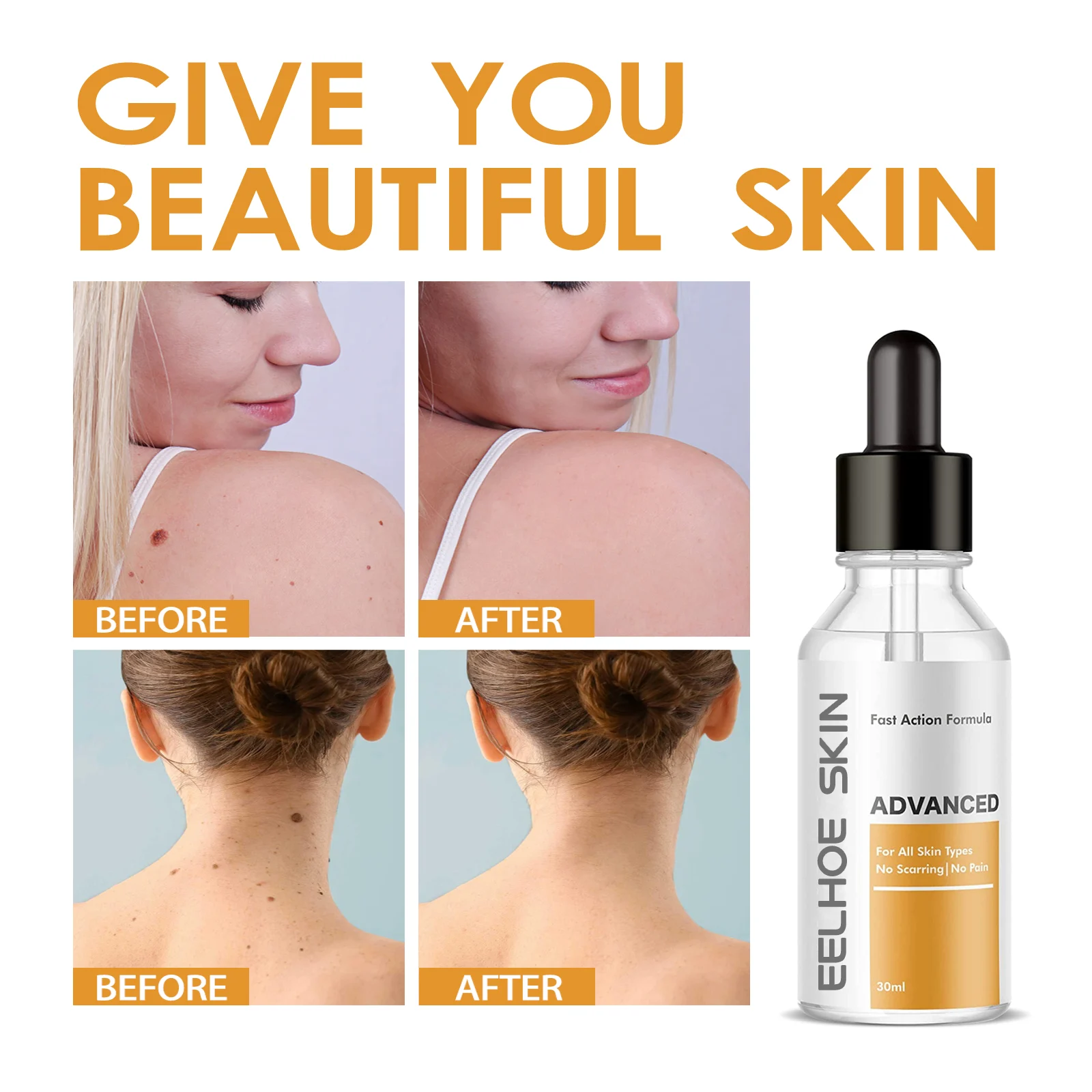 Wart Removal Serum 30ml for Skin Tags, Moles & Calluses - Fast Action Formula 9 eelhoe wart removal serum 30ml cih wgyubj63 desc 9