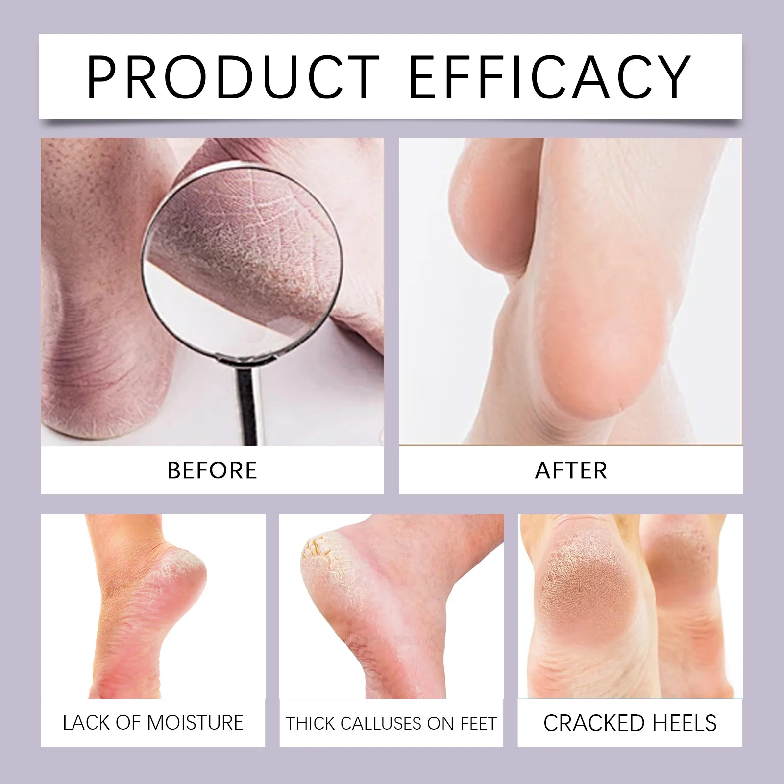 Foot Care Cream Moisturizing Callus Remover 20g for Dry Cracked Heels 8 foot care cream callus remover 20g cih mjj5s97b desc 9