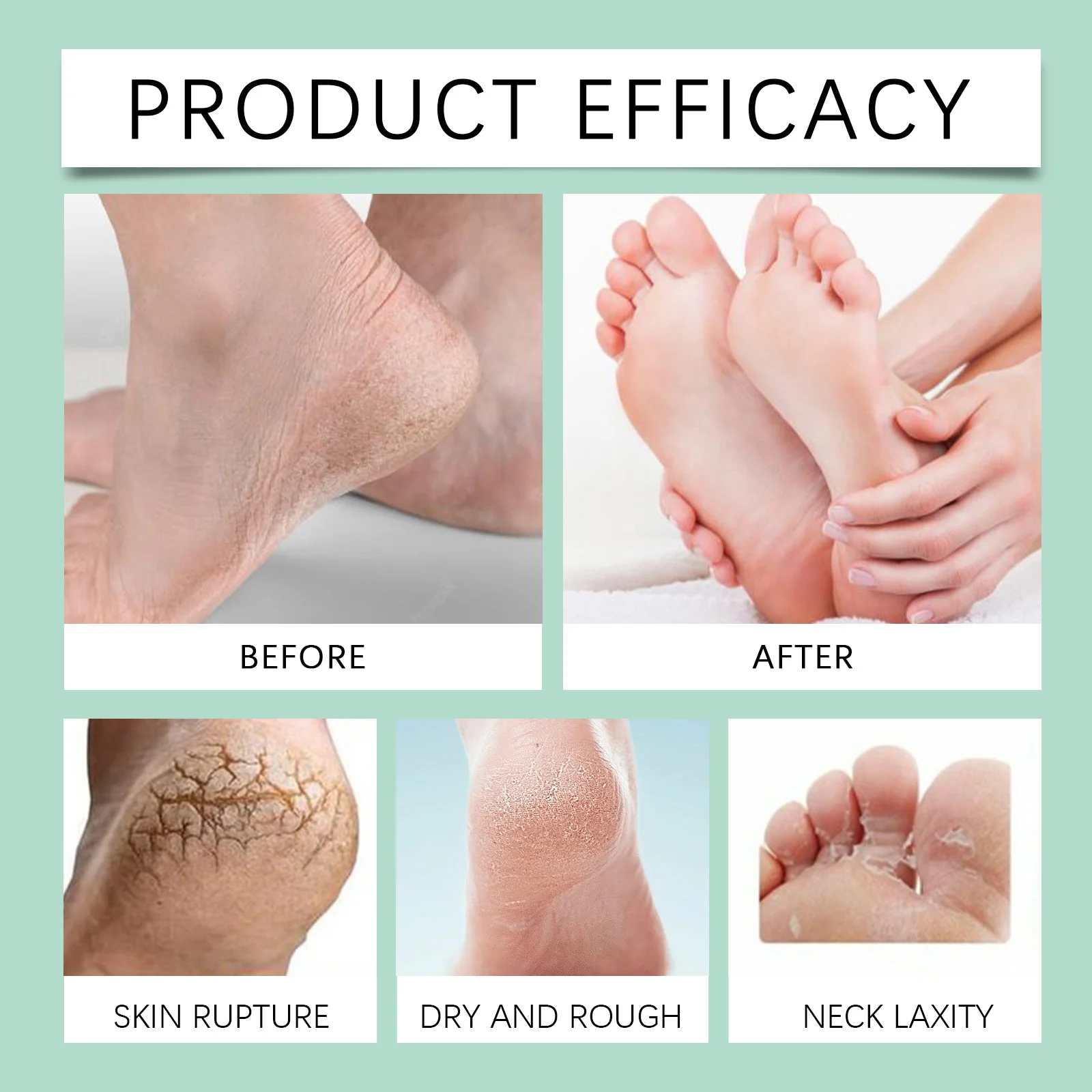 OceAura Rapid Foot Peeling Spray with Hyaluronic Acid and Green Tea Oil for Soft, Smooth Feet 10 foot peeling spray cih 2baxmujp desc 10