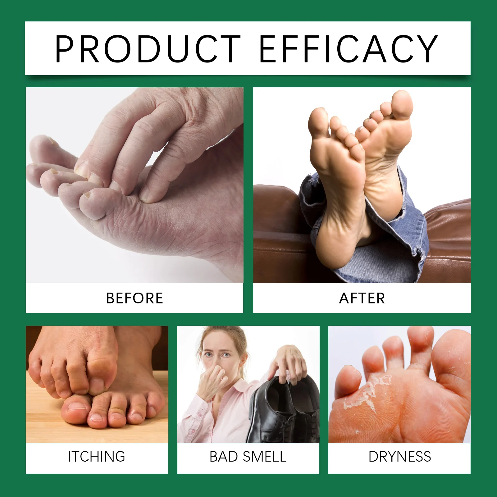 Foot Peeling Spray with Orange Oil Allantoin & Salicylic Acid for Callus Removal Moisturizing 100ml 12 foot peeling spray orange oil callus removal 100ml cih m7t45znw desc 12