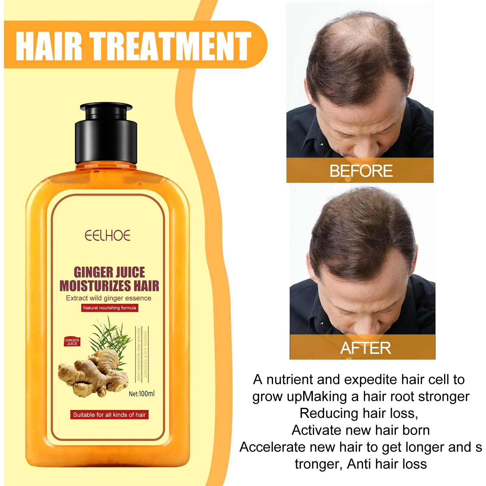 Ginger Anti-Hair Loss Shampoo Moisturizes Hair Follicles Reduces Shedding 100ml 4 ginger anti hair loss shampoo 100ml cih 3ata2v4d desc 4