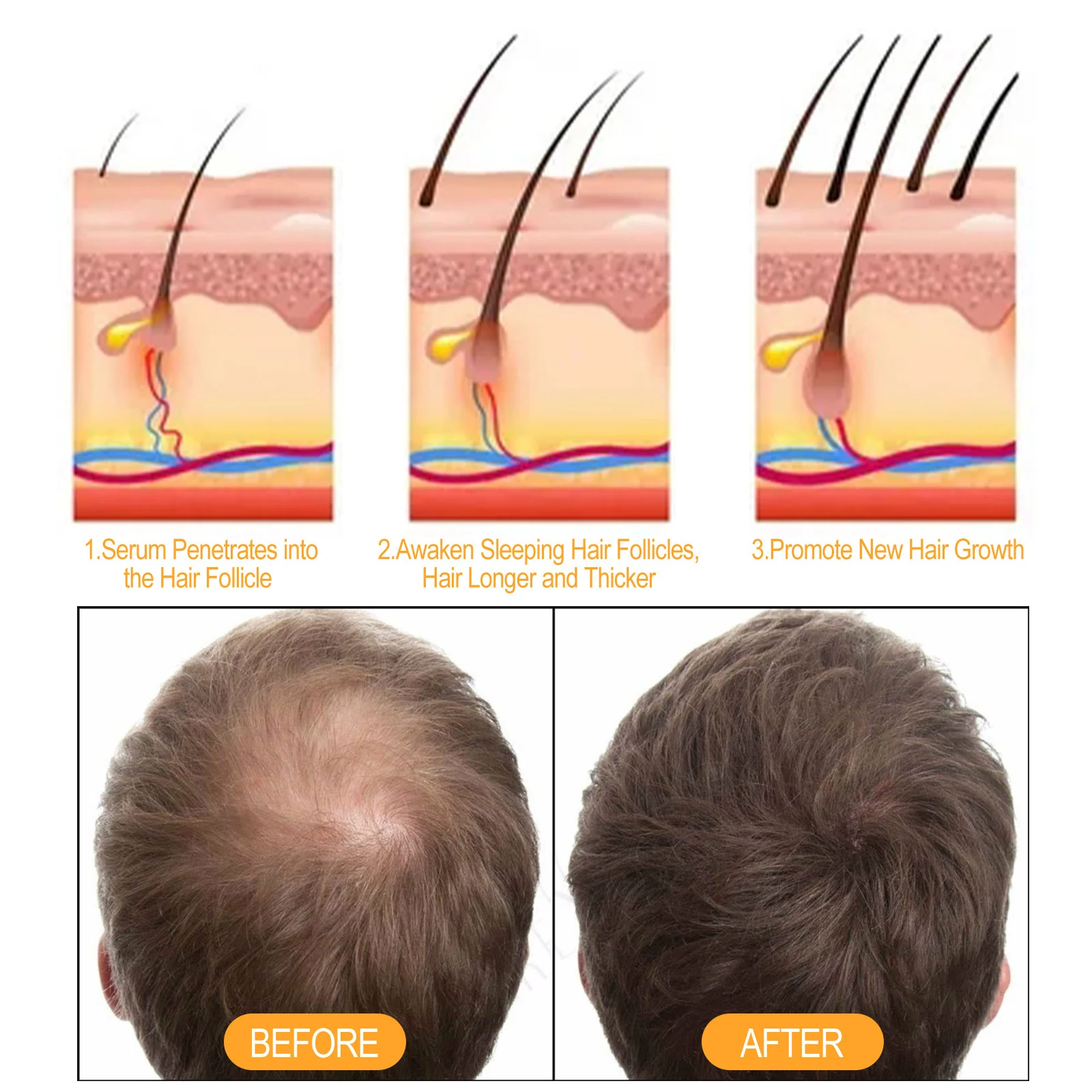 Ginger Anti-Hair Loss Shampoo Moisturizes Hair Follicles Reduces Shedding 100ml 7 ginger anti hair loss shampoo 100ml cih 3ata2v4d desc 7