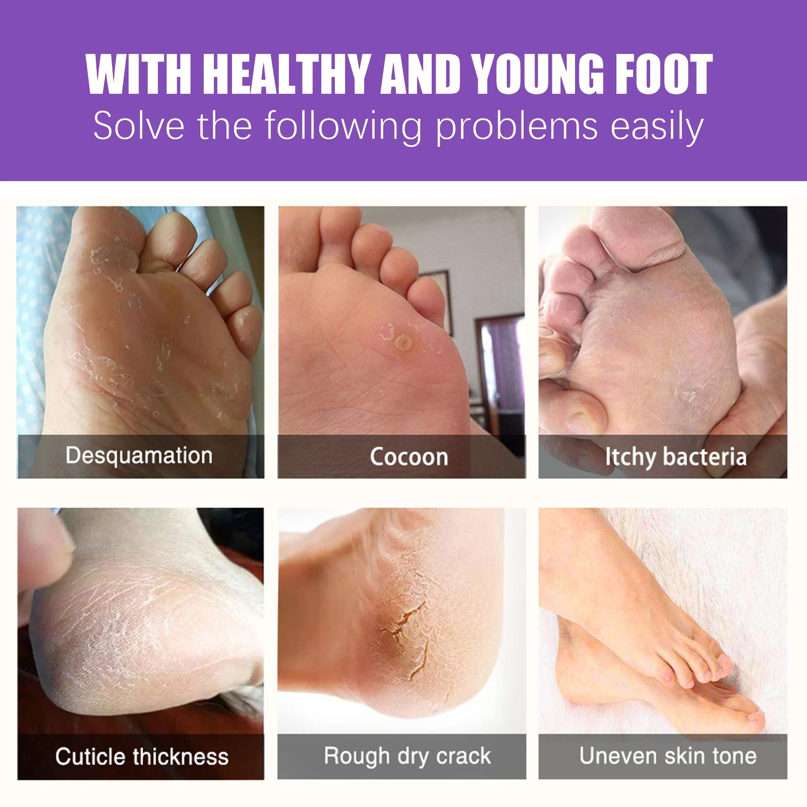 Ginger Foot Mask Pairs Exfoliating Foot Peel Mask for Dry Cracked Heels Callus Removal 5 ginger foot mask pairs exfoliating foot peel mask cih vxjx8b3y desc 5