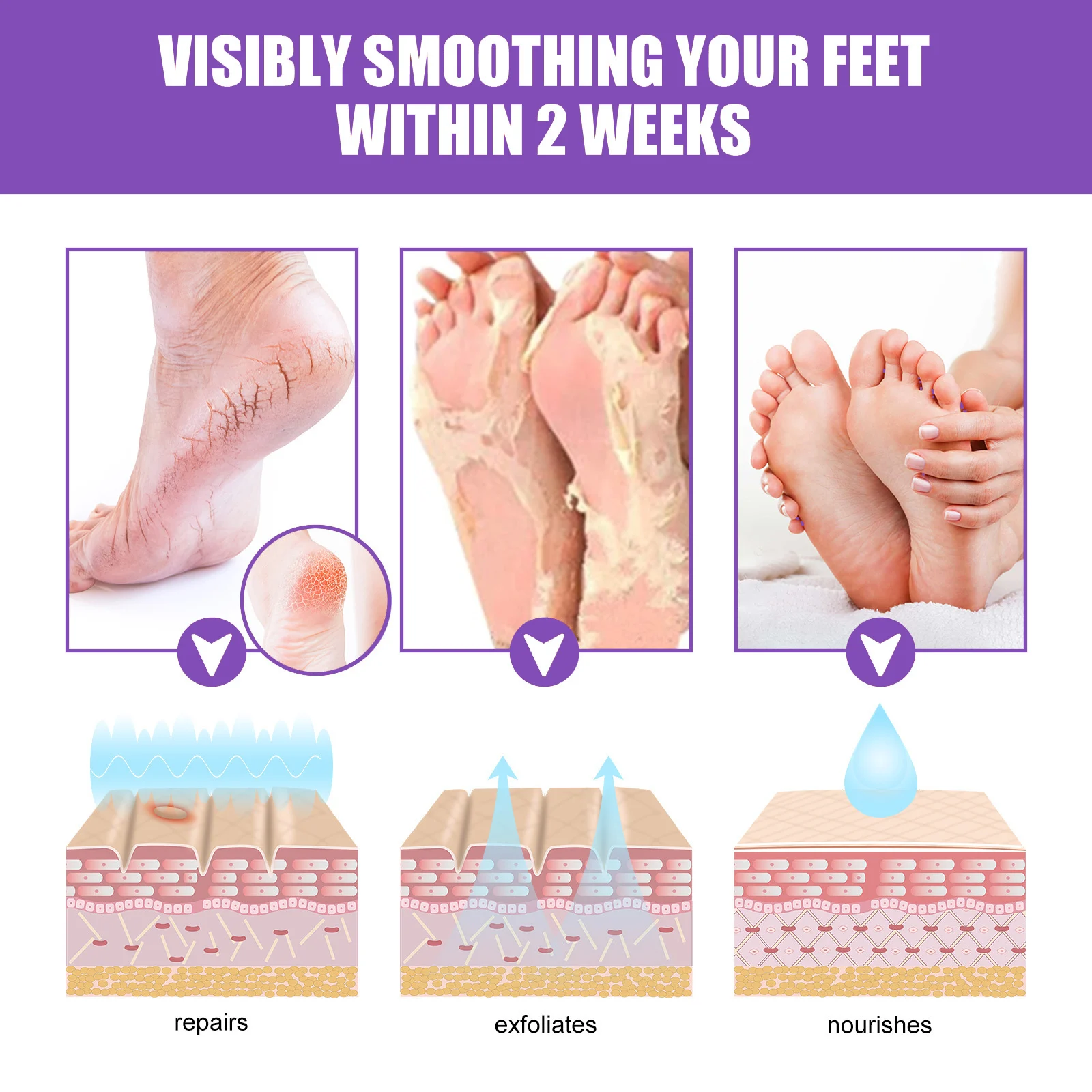 Ginger Foot Mask Pairs Exfoliating Foot Peel Mask for Dry Cracked Heels Callus Removal 7 ginger foot mask pairs exfoliating foot peel mask cih vxjx8b3y desc 7