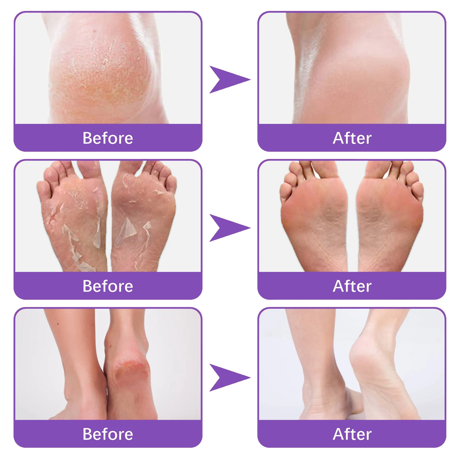 Ginger Foot Mask Pairs Exfoliating Foot Peel Mask for Dry Cracked Heels Callus Removal 9 ginger foot mask pairs exfoliating foot peel mask cih vxjx8b3y desc 9