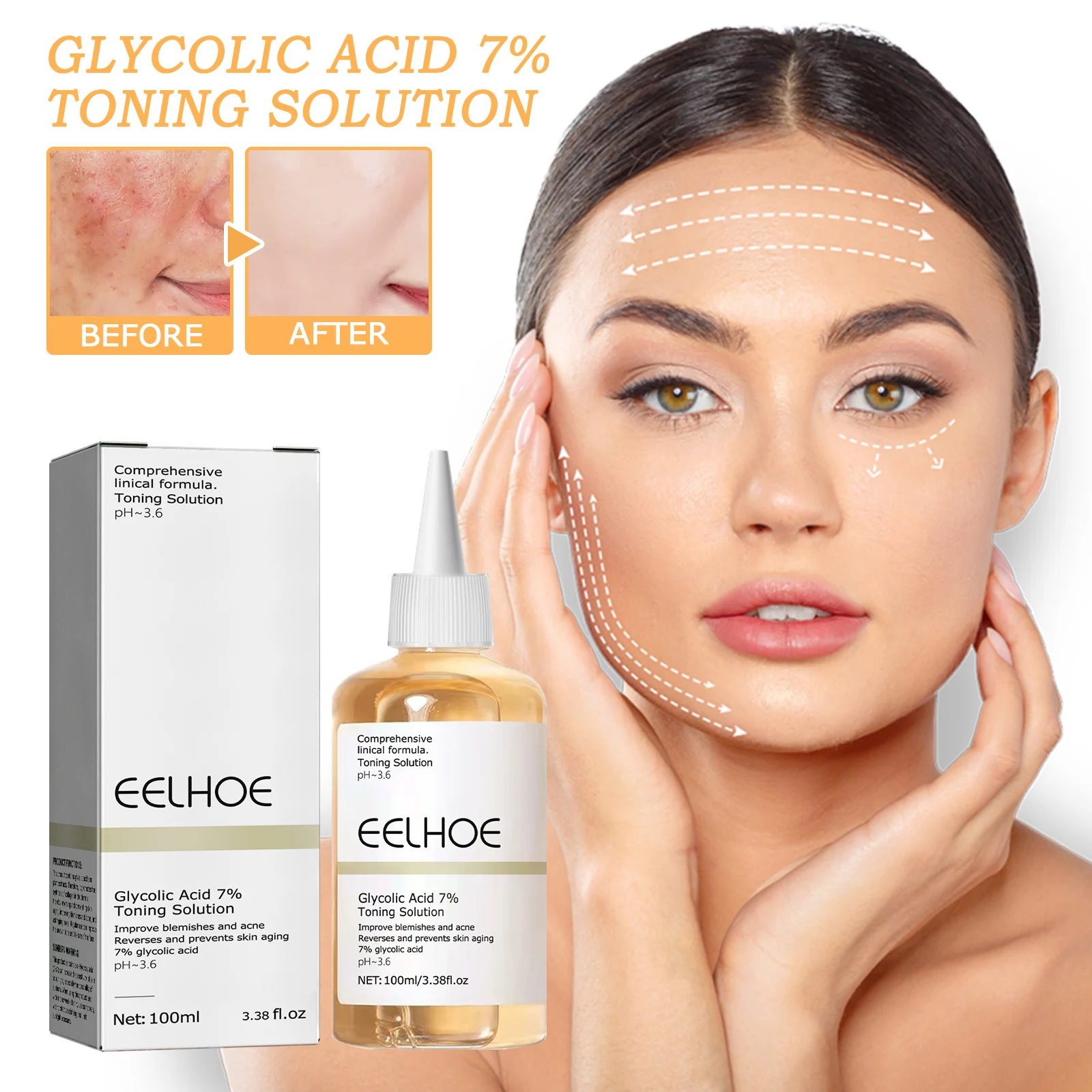 Glycolic Acid 7% Toning Solution 100ml for Acne, Blemishes & Pore Refining 2 glycolic acid 7 percent toning solution 100ml cih bha4zrab desc 2