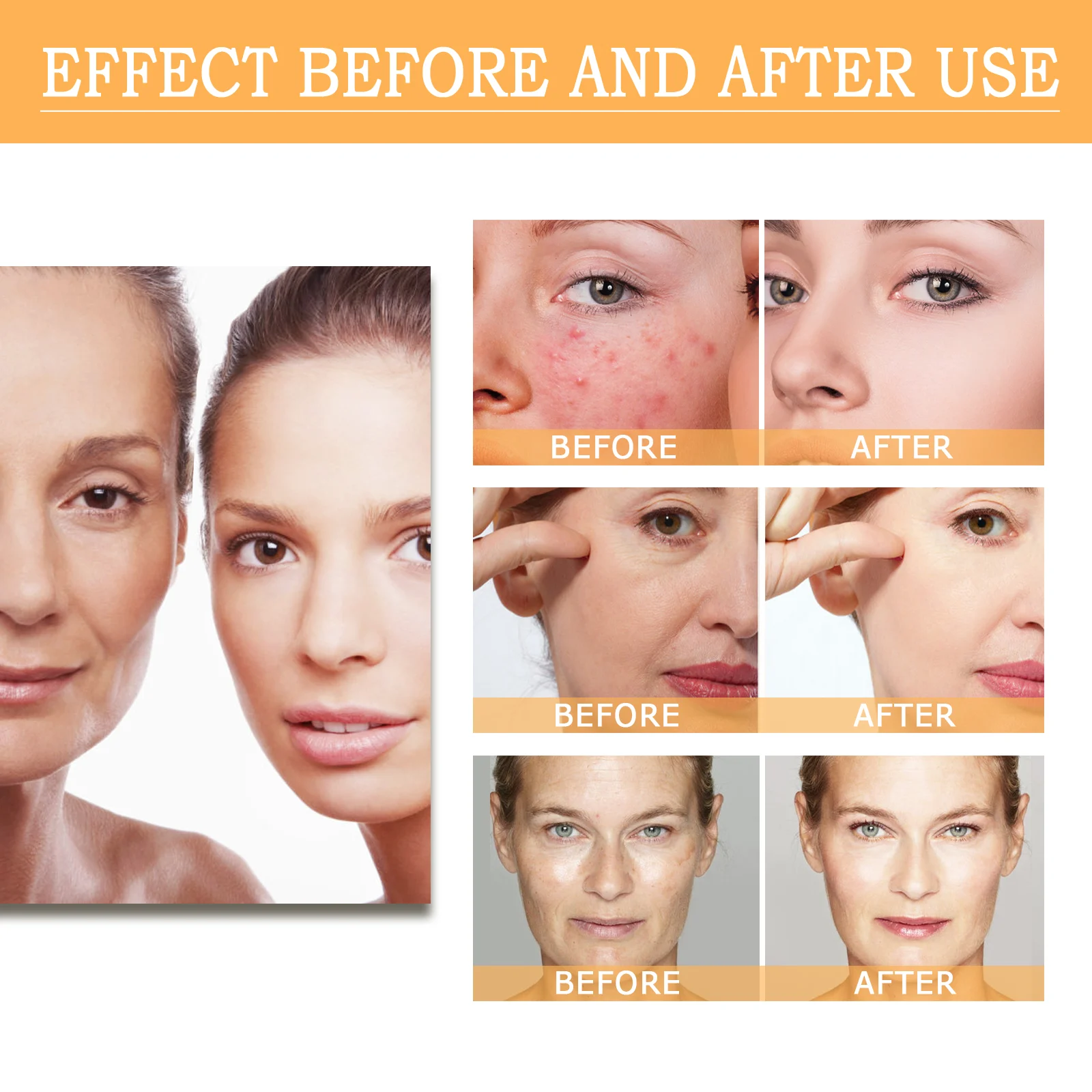 Glycolic Acid 7% Toning Solution 100ml for Acne, Blemishes & Pore Refining 8 glycolic acid 7 percent toning solution 100ml cih bha4zrab desc 8