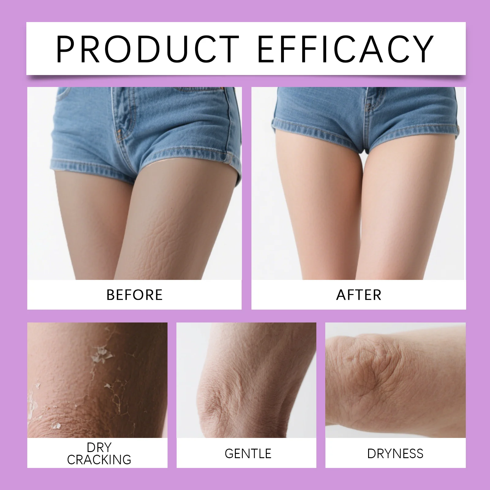 Glycolic Acid Exfoliating Body Stick 75g for Rough & Uneven Skin, Portable Care 13 glycolic acid exfoliating body stick 75g der 83ewp9bz desc 13