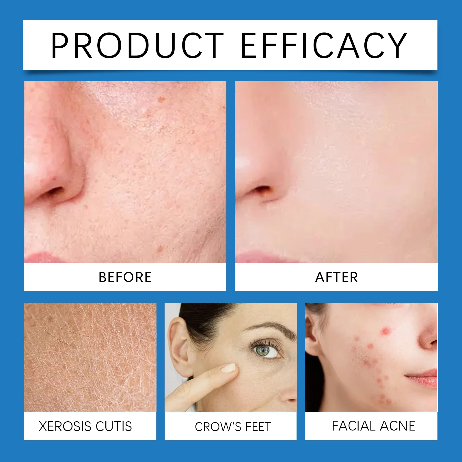 Glycolic Acid Exfoliating Pads for Deep Cleansing, Brightening & Skin Renewal 40 Pads 9 glycolic acid exfoliating pads 40 pads cih 658t7p97 desc 9