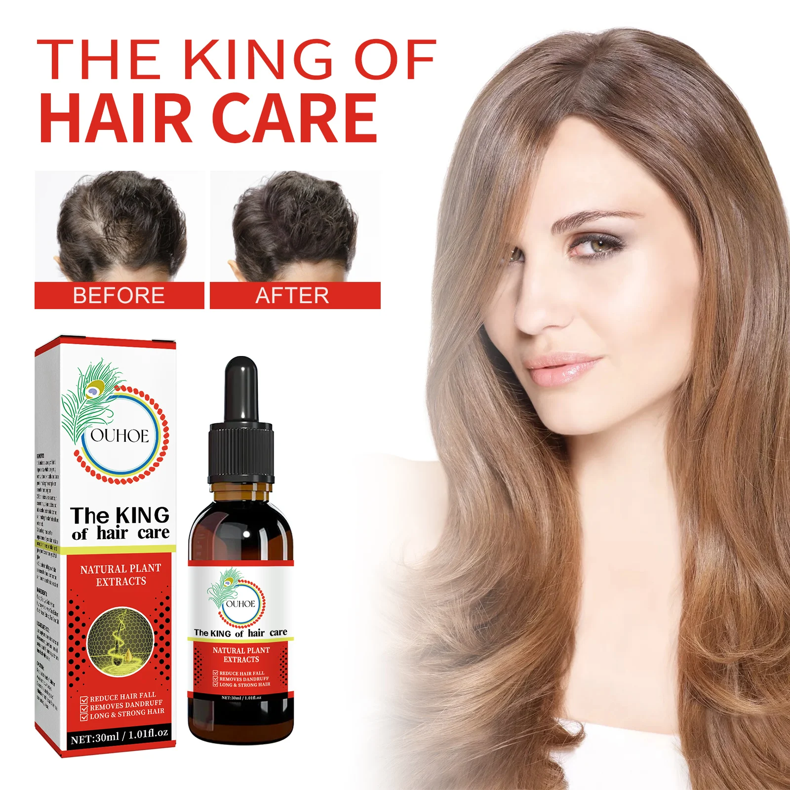 OUHOE Hair Care Oil with Plant Extracts - Reduces Hair Loss, Dandruff Control, Scalp Nourishment 2 hair care oil treatment cih 9fzju5dc desc 2