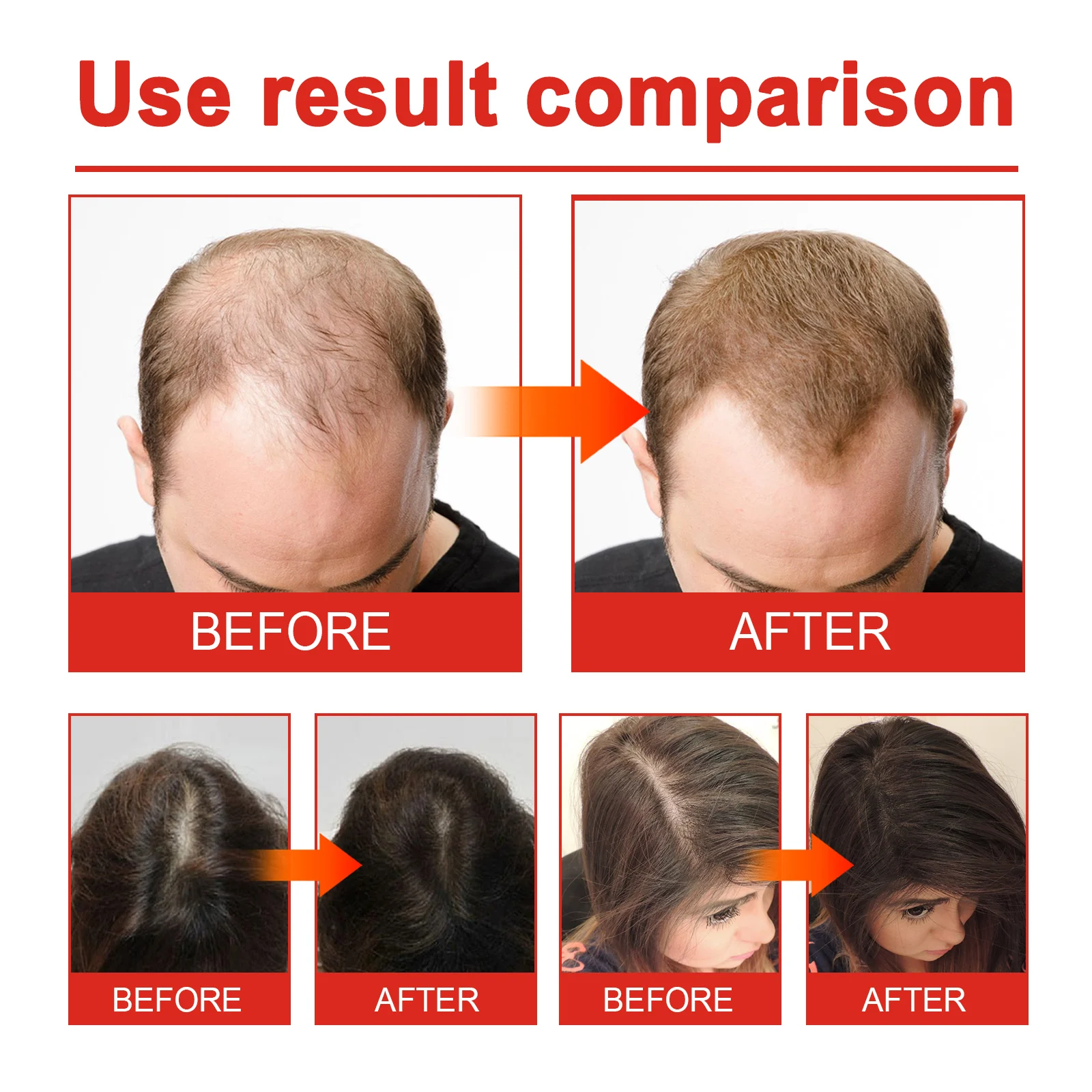 OUHOE Hair Care Oil with Plant Extracts - Reduces Hair Loss, Dandruff Control, Scalp Nourishment 9 hair care oil treatment cih 9fzju5dc desc 9