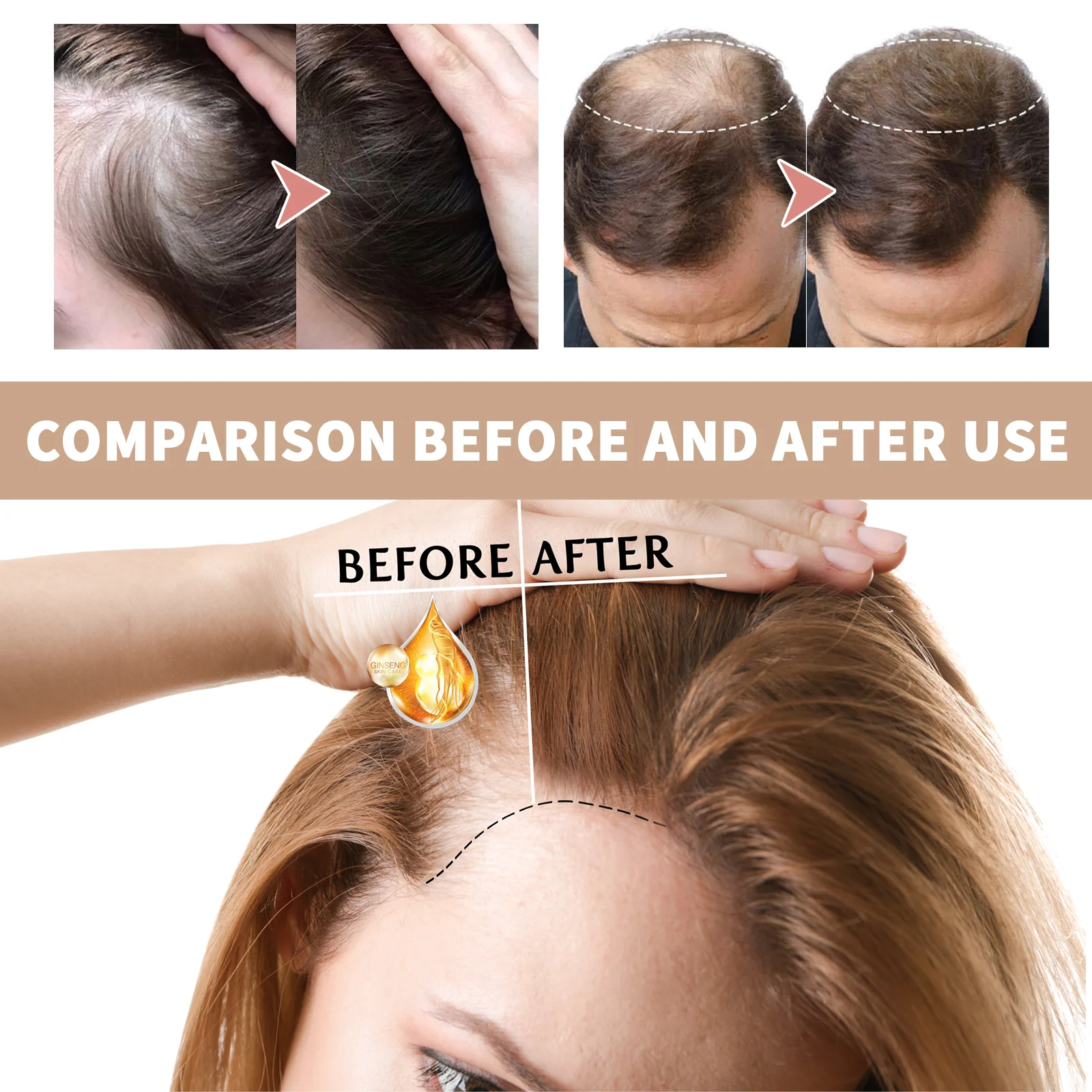 OUHOE Hair Growth Oil for Thicker Hair, Reduces Hair Loss, Nourishes Roots 8 hair growth oil essence cih g4j7tfk7 desc 8