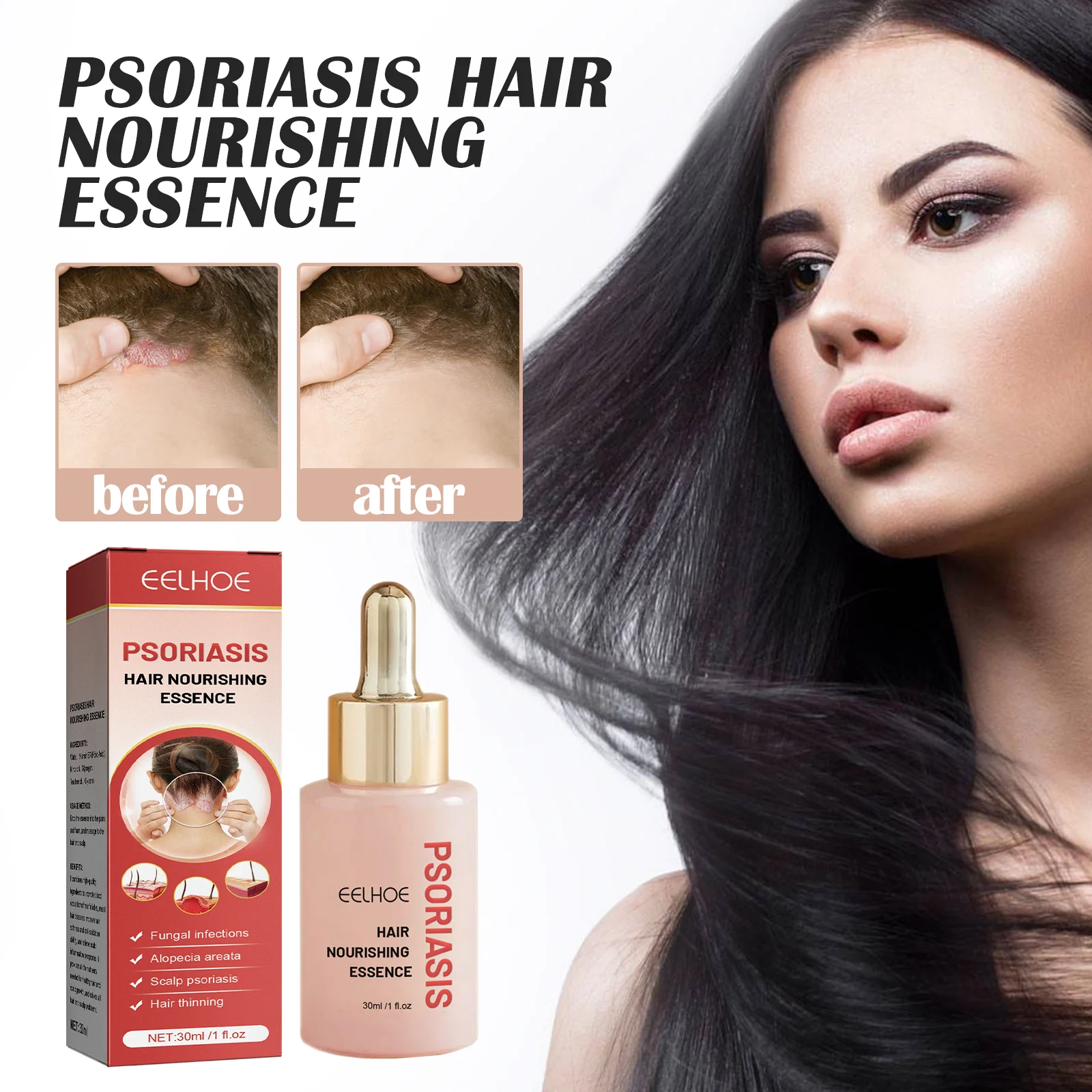 Hair Nourishing Essence Scalp Treatment for Dandruff Control & Psoriasis Relief 30ml 2 hair nourishing essence scalp treatment dandruff control psoriasis 30ml cih qv7pancq desc 2