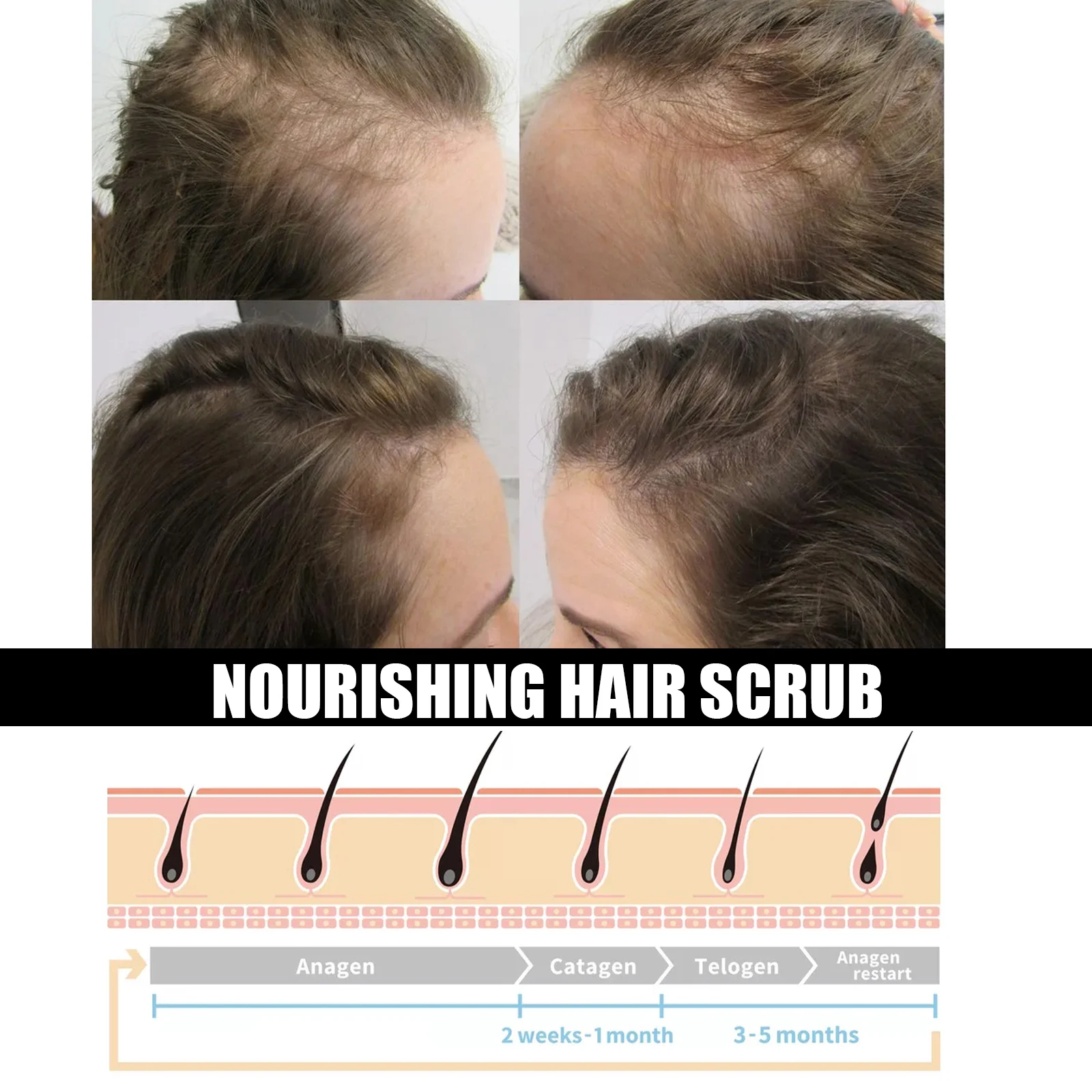 Hair Scalp Scrub 100g for Deep Root Cleaning, Hair Loss Prevention & Follicle Nourishment 7 hair scalp scrub 100g cih w22yua5q desc 7