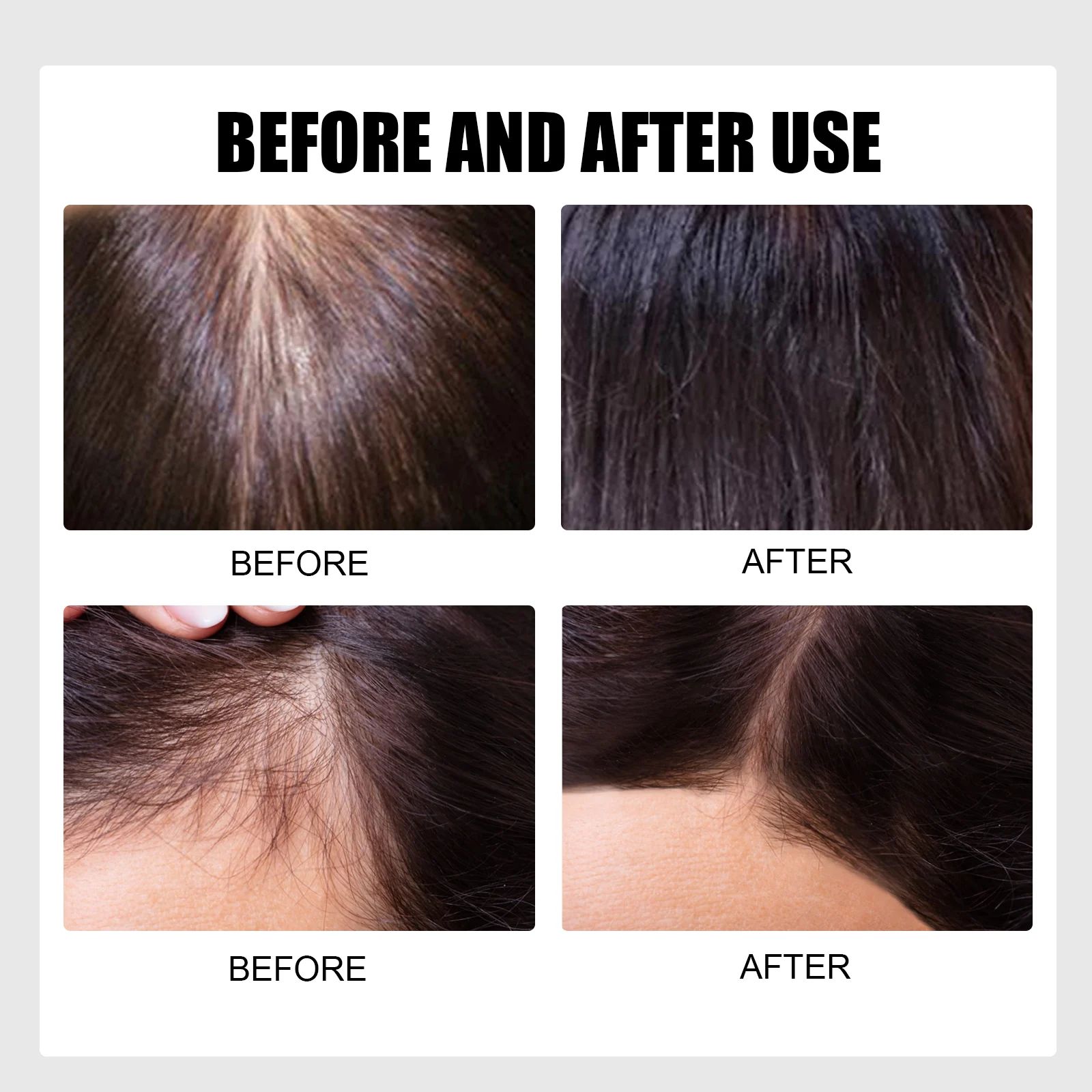 Hair Scalp Scrub 100g for Deep Root Cleaning, Hair Loss Prevention & Follicle Nourishment 9 hair scalp scrub 100g cih w22yua5q desc 9