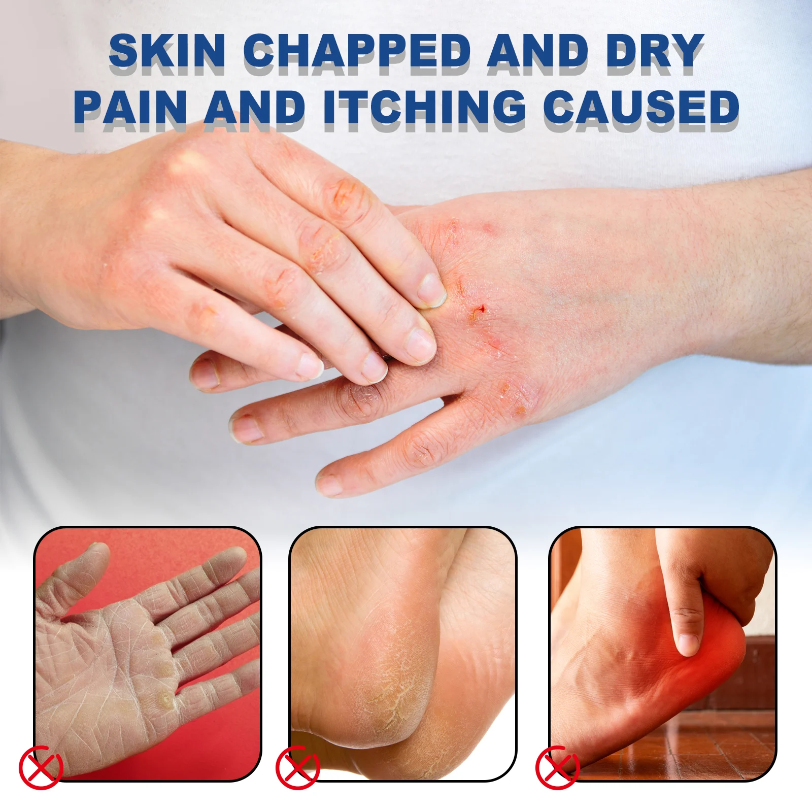 Hoygi Hand & Foot Care Cream Stick with Urea and Salicylic Acid for Dry Cracked Skin 5 hand foot care cream stick cih agdgu7r8 desc 5