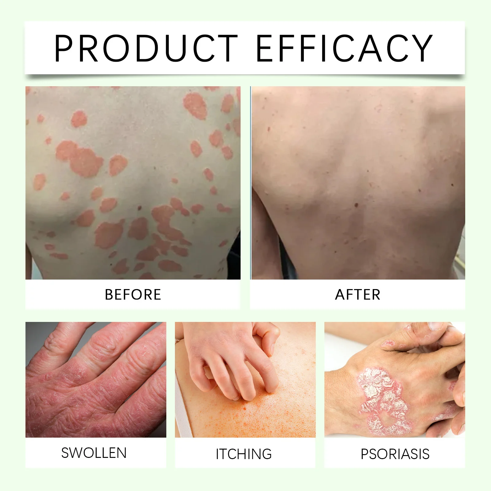 OUHOE Herbal Body Lotion with Tea Tree & Licorice for Soothing, Moisturizing & Skin Repair 11 herbal body lotion cream cih 83afrx65 desc 11