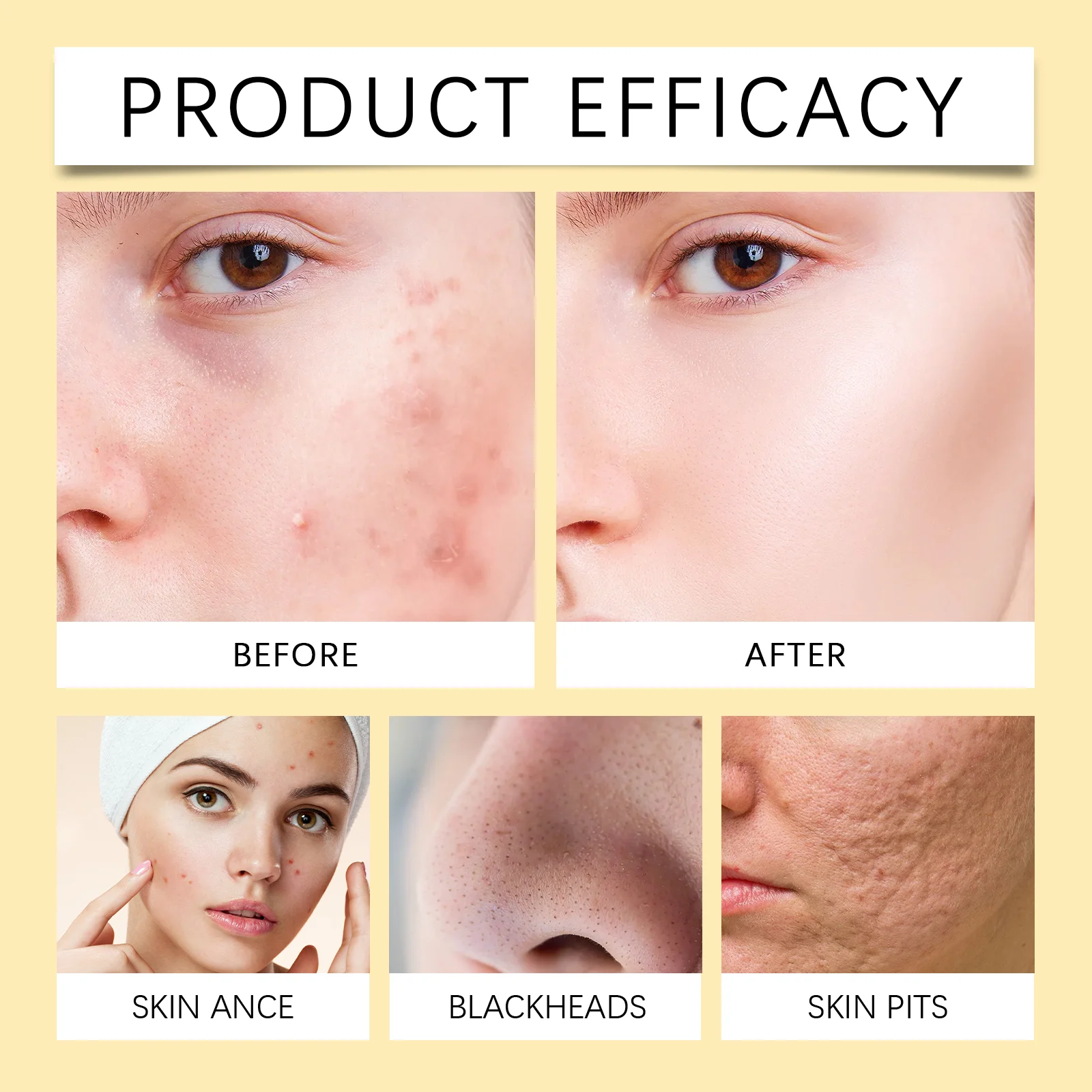 OUHOE Gentle Honey Foam Facial Wash - Deep Cleansing, Acne Control, Oil Balance 8 honey foam facial wash cih ue6nc3tq desc 8