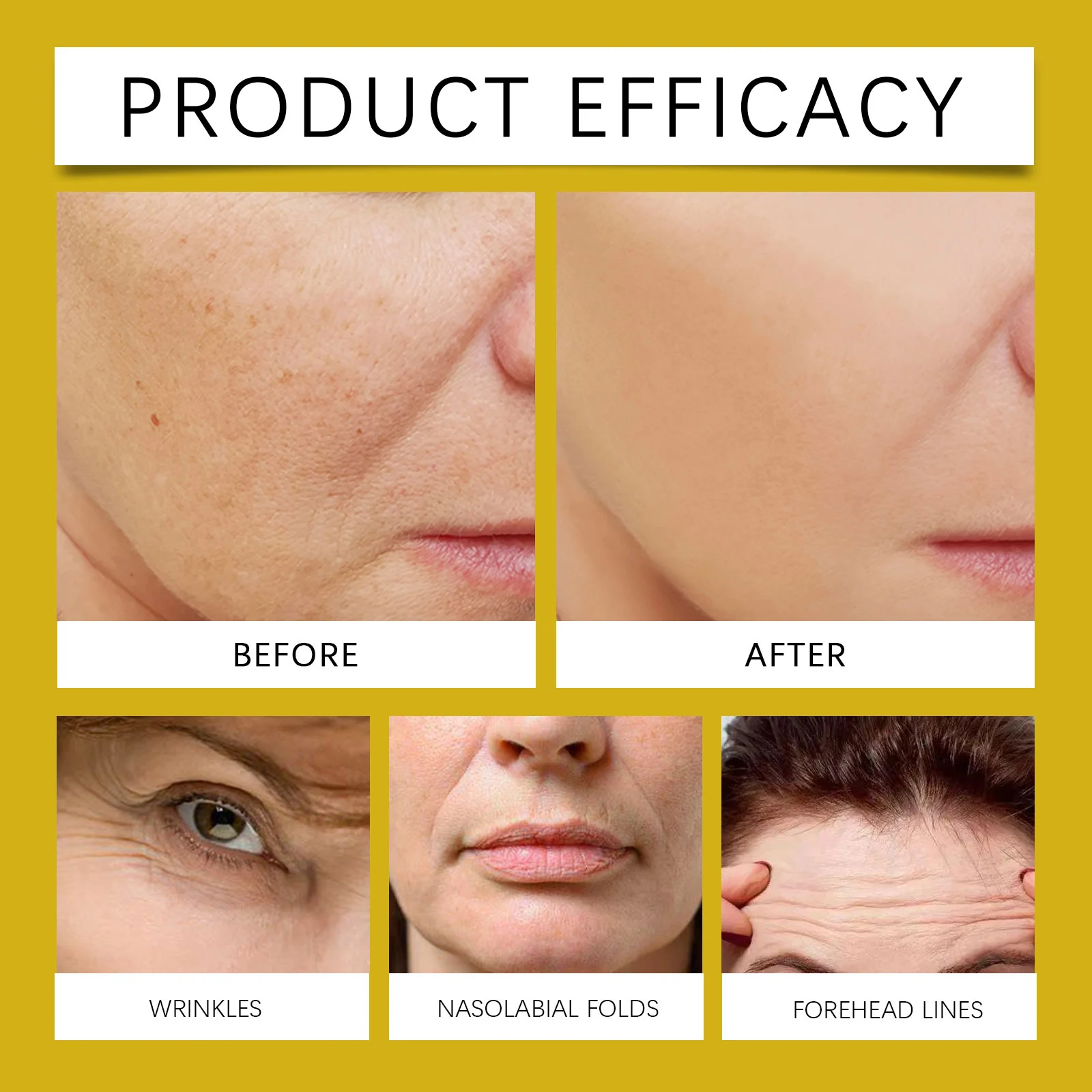Bee Venom Firming Cream 50g Hydrating Moisturizer for Youthful Skin 9 hoygi bee venom firming cream 50g der npmeskjm desc 9