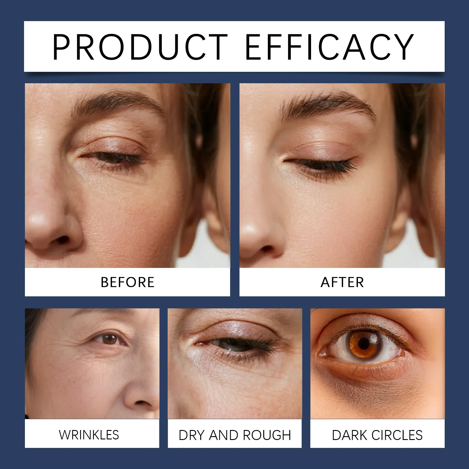 Eye Cream for Wrinkles and Hydration 15g Anti-Aging & Firming Eye Lifting Cream 9 hoygi eye lifting cream 15g der 9akkqgsw desc 9