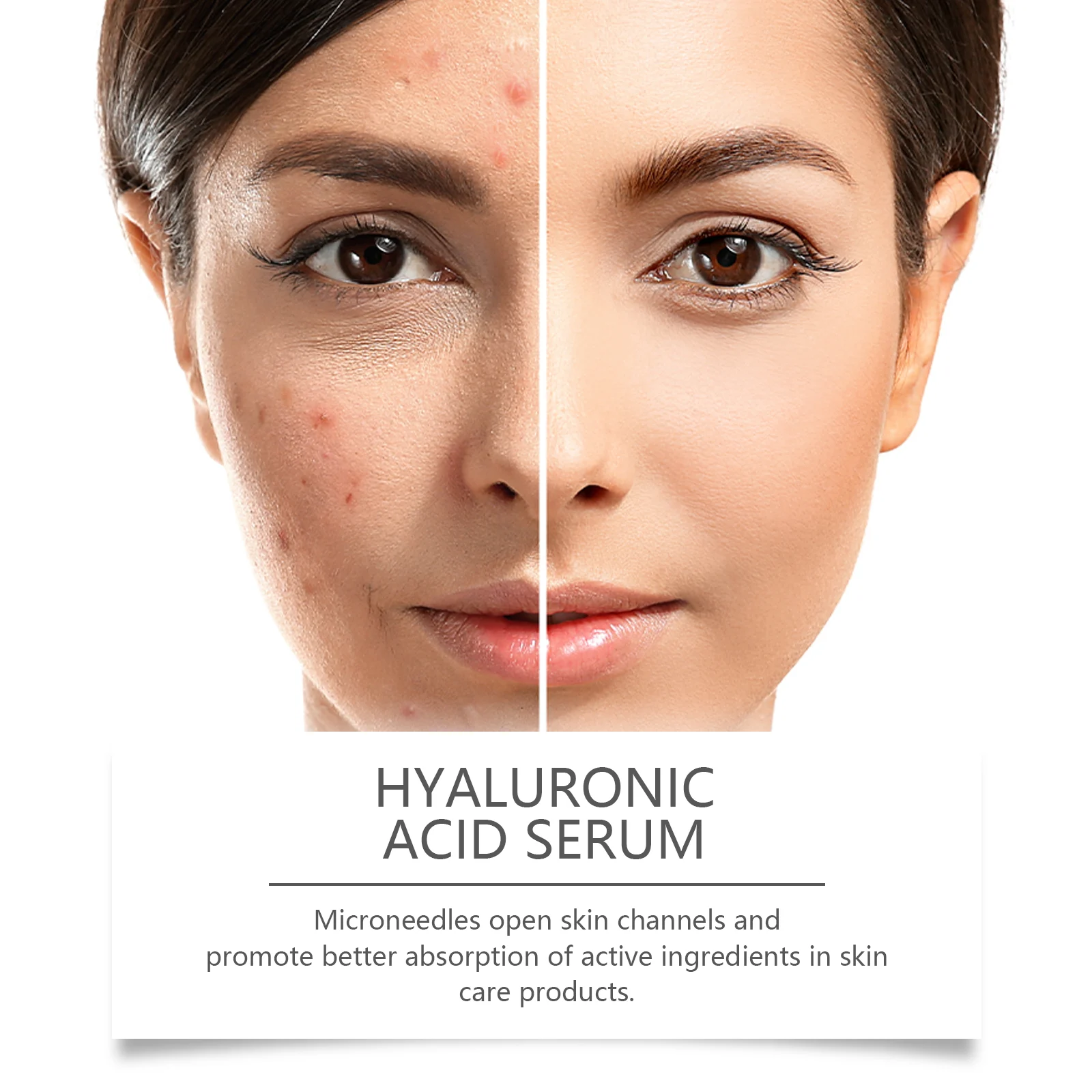 Hyaluronic Acid Roller Serum 10ml Face Moisturizing Essence with 64 Micro-Needles 7 hyaluronic acid roller serum 10ml cih c6w8cp5w desc 7
