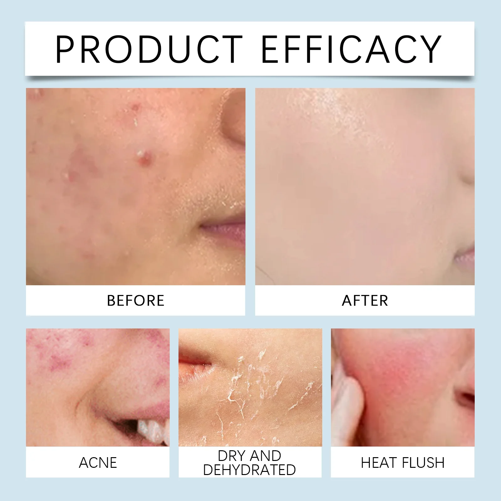 Hyaluronic Acid Roller Serum 10ml Face Moisturizing Essence with 64 Micro-Needles 9 hyaluronic acid roller serum 10ml cih c6w8cp5w desc 9