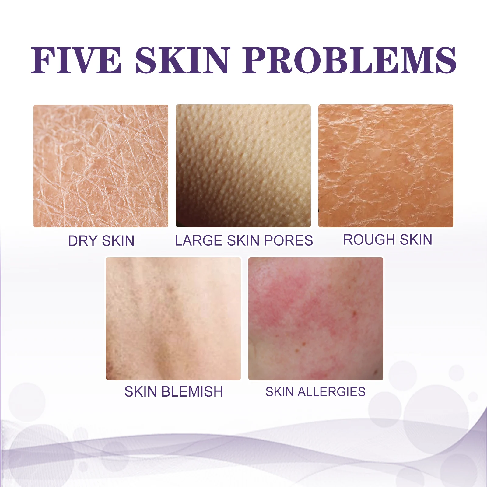 KP Bump Remover Cream for Rough & Bumpy Dry Skin, 100ml 6 kp bump remover cream rough bumpy dry skin 100ml cih 8mtgba8z desc 6