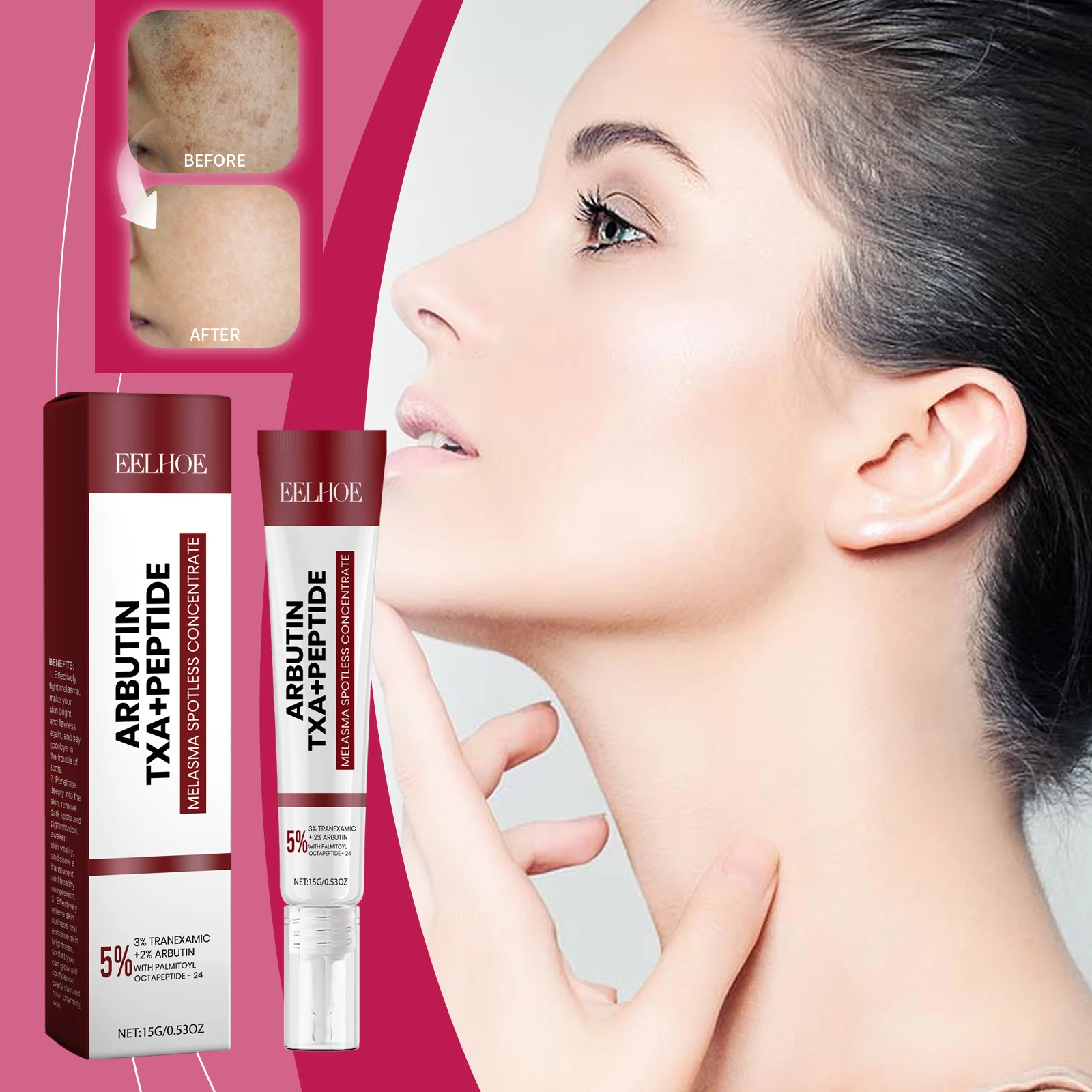Melasma Spotless Concentrate TXA+Peptide Arbutin Dark Spot Removal Cream 15g 2 melasma spotless concentrate txa peptide arbutin dark spot removal cream 15g cih 9r4x6kc6 desc 2 1