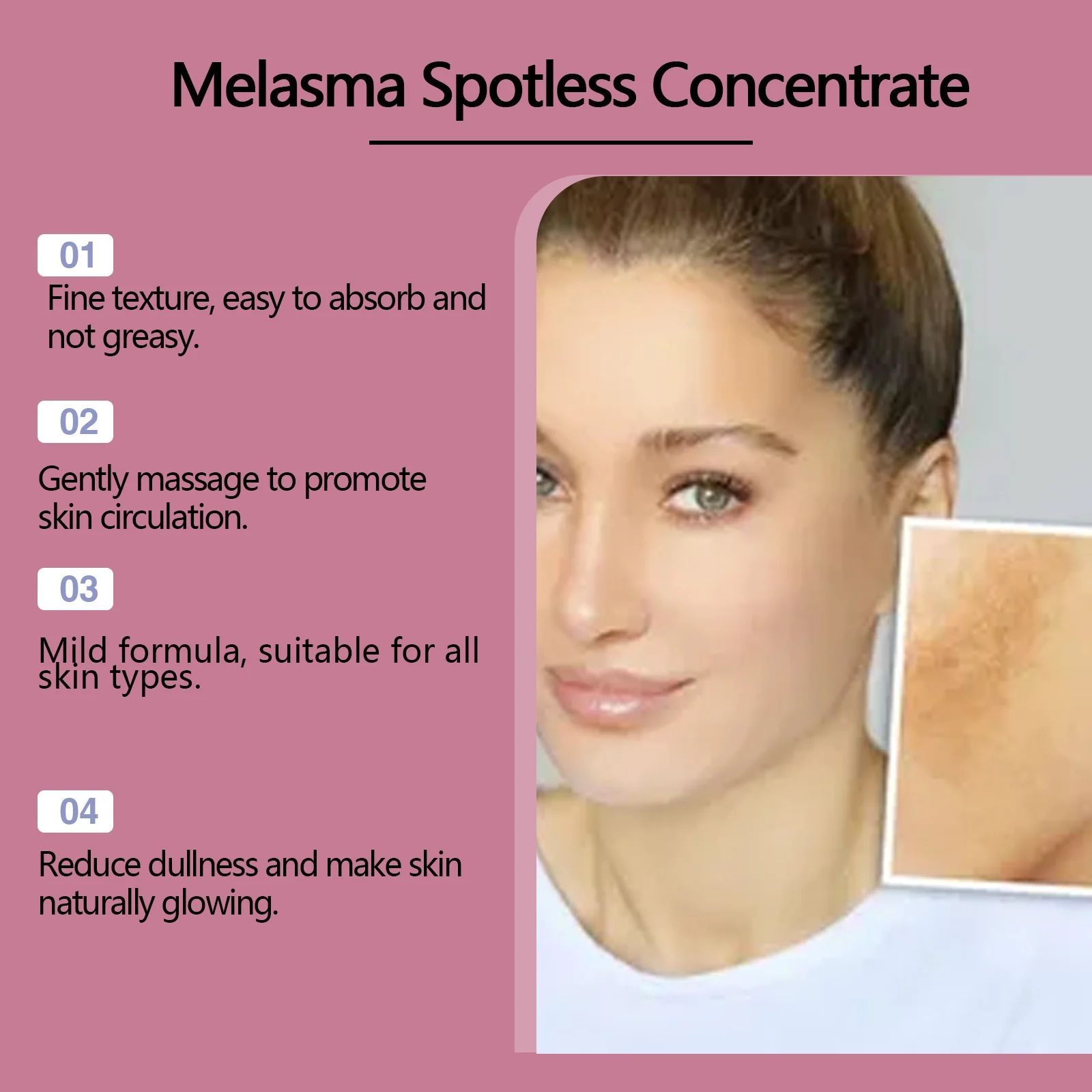 Melasma Spotless Concentrate TXA+Peptide Arbutin Dark Spot Removal Cream 15g 7 melasma spotless concentrate txa peptide arbutin dark spot removal cream 15g cih 9r4x6kc6 desc 7