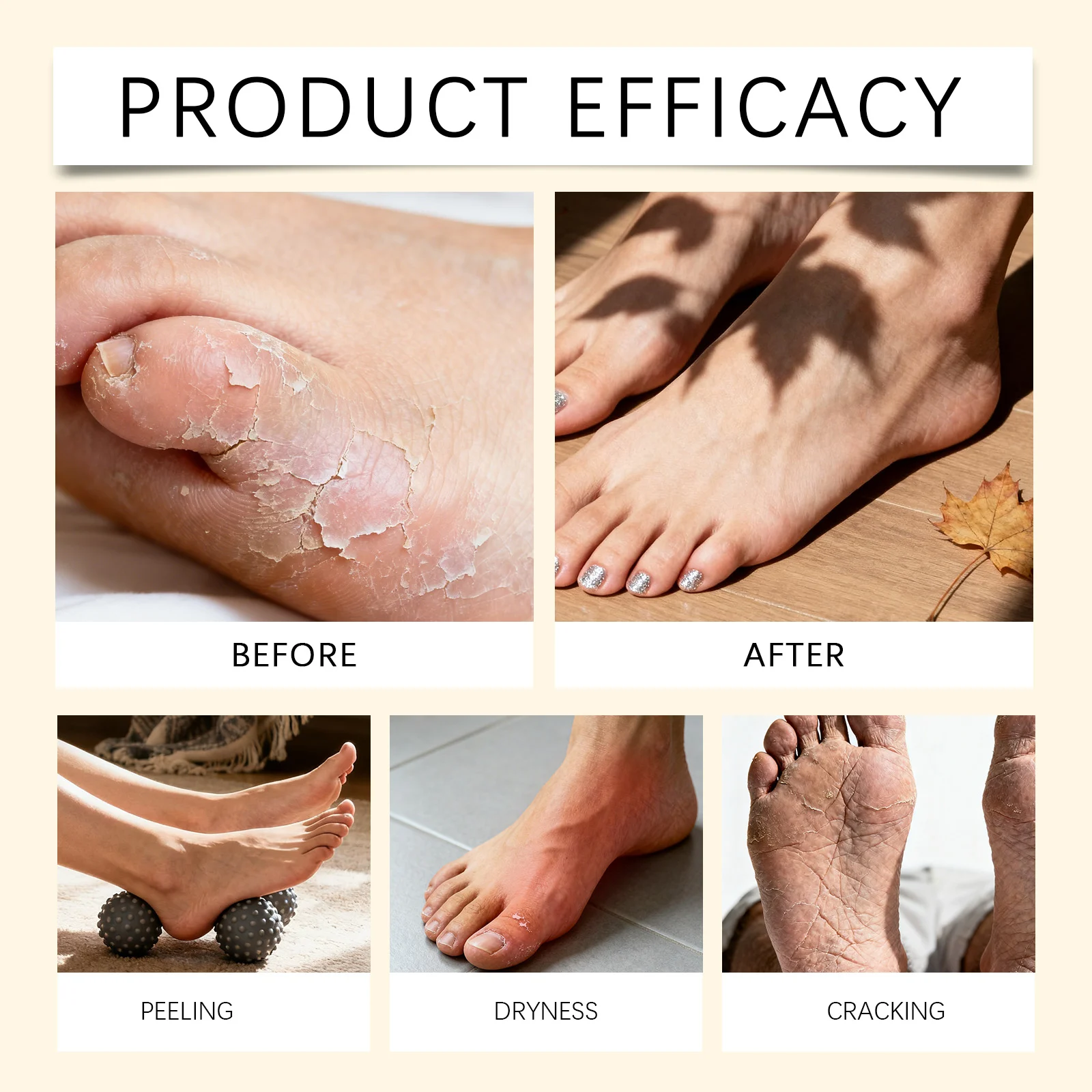 OceAura Moisturizing Cream for Dry Cracked Heels, Face & Body, Hydrating Foot Care 12 moisturizing cream dry heel der rq2pmd57 desc 12