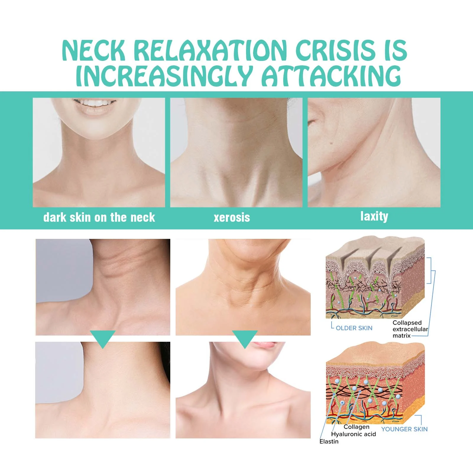 Hoygi Neck Firming Cream Reduce Neck Wrinkles Hydrate Rejuvenate Skin Tightening 6 neck firming cream cih jgznx4fs desc 6