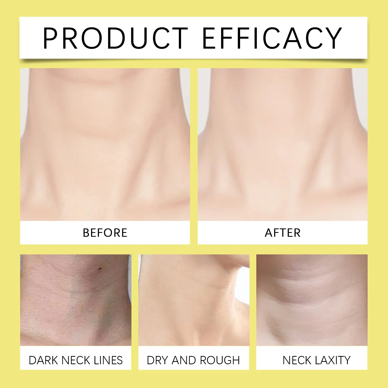 Neck Firming Cream Tighten Skin Nourish Hydrate Reduce Neck Lines Lift Contour 150g 12 neck firming cream tighten skin nourish hydrate 150g cih bwgh9fev desc 12